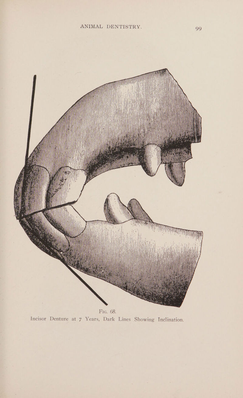 ———-* ————————— ————— —S—S—S== al ™ i ee ae | bai Wy HARA NK Wd ll Hah a . oli! ith iit | hit vv U i Fic. 68. incisor Denture at 7 Years, Da Ges i oe se - = ——&lt;$—$— ee ——SS&gt;= i (is : \ ‘
