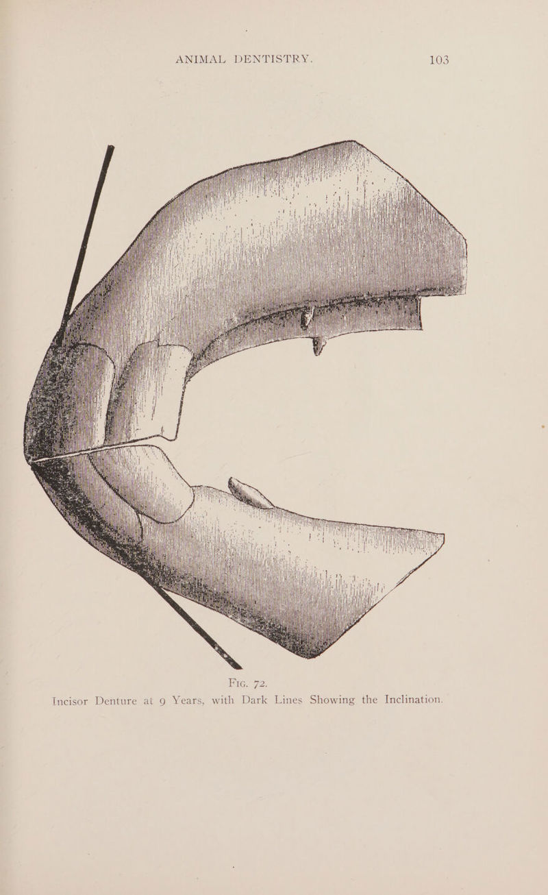 : ae ii ia , Wt pts Niner i ay f Incisor Denture at 9 Years, with Dark Lines Showing the Inclination.