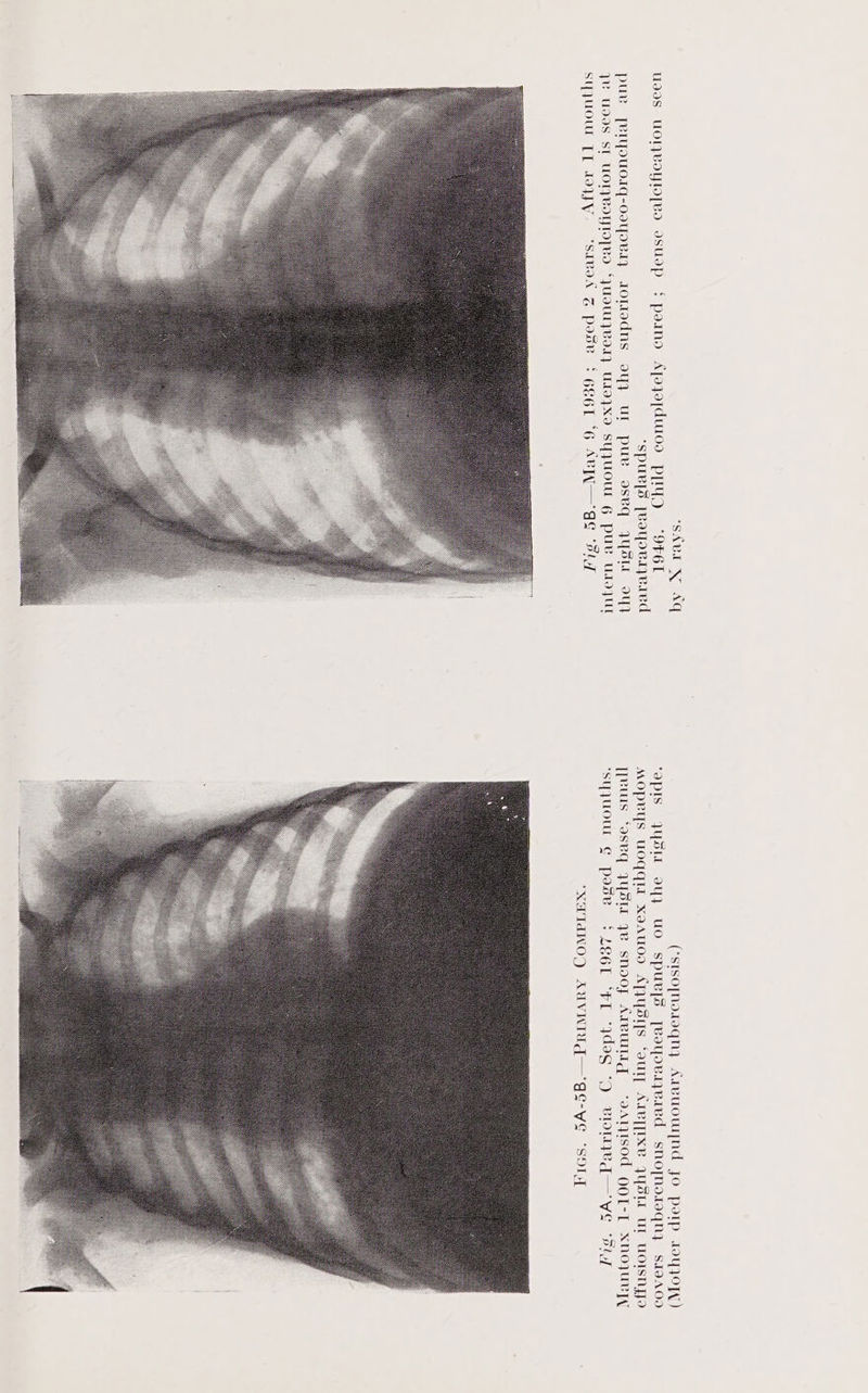 (stsopno.oqny Areuowypnd Jo potp YAO) ‘OpIs JYUSIL oy} UO SpuURIS [BotoRayRied sno[nodteqny siaA00 MOpBYs UOGQIE X9AUOD ATIYSYS ‘out, AdeT[EXe JUSIe UL UOISNAo ]eurs Soseq yYySte ye snoofy Areurtig ‘oarqisod OQOL-L xnoyuryy ‘syyuoUuL G pose {2E6L “FL “9d99 -O BIoIegd—VE ‘sly . ek ‘XATINWODQ AUVWIUG—gE-VE “SOIT
