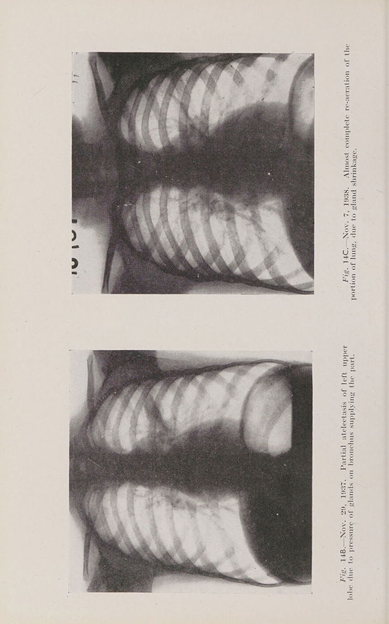 “QGVYULLYS PULLS OF ONp “Suny, JO uoAwod avd oy, sursyddns snyouorq uo spuvys Jo oanssoad 0} onp IO] IY} JO UOLVAIV-oL OJO[CULOD YSOUITY “SEGL 62 “AON —OFL ‘Fly7 qoddn 4jeayT JO sisvzosjoye [ened “LE6L ‘6G “AON—gFL °32,