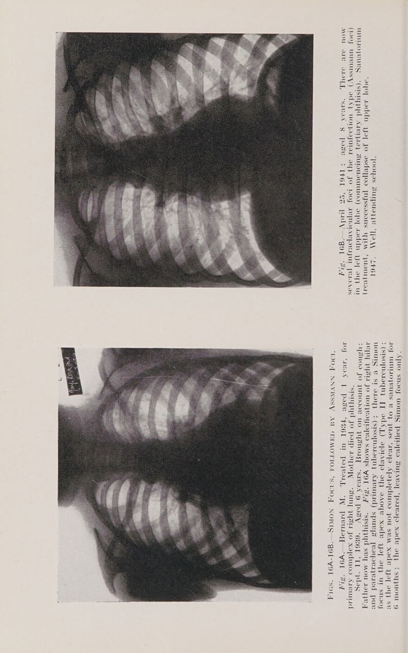 AOE NOWIS—gOL-YOL “SDT
