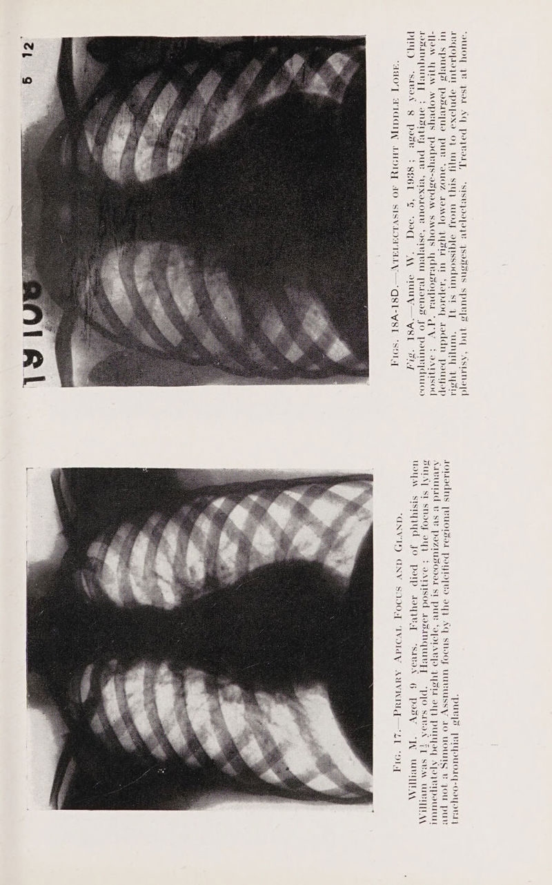 “OUIOY YW YSvl AG Povo], ISUJOV[9Jw JSosGons spuvps ynq ‘Astimoyd IVQO[IVJUL IPNfOXI OF WAY Styy Wrorp oPqussodurt st 4p “UIMyzLY FYStd Ul SpUuv[S Pysiv[Ud PUB *9UOZ LIMO] FYSLE UL ‘dapsoq aoaddn pauyop -]JoM YI MOpLys podvys-v65pom SMOYS YdRasoIpRL qry +} 9Atisod LIGMNQCUIL]T $onsiyey pue ‘evixo1oue ‘osteypeul Tetouss JO pouTey_duod PIY) ‘stwad Q pose : 8e6L ‘E ‘Ooq “AA OTUUY—YyR8I ‘stu “HMO'T AIGAGI LHOIY AO SISVLOUTALY—‘'QG8I-V8I ‘SOIT N ‘puvps PRrmpouoiq-OoyoRs]