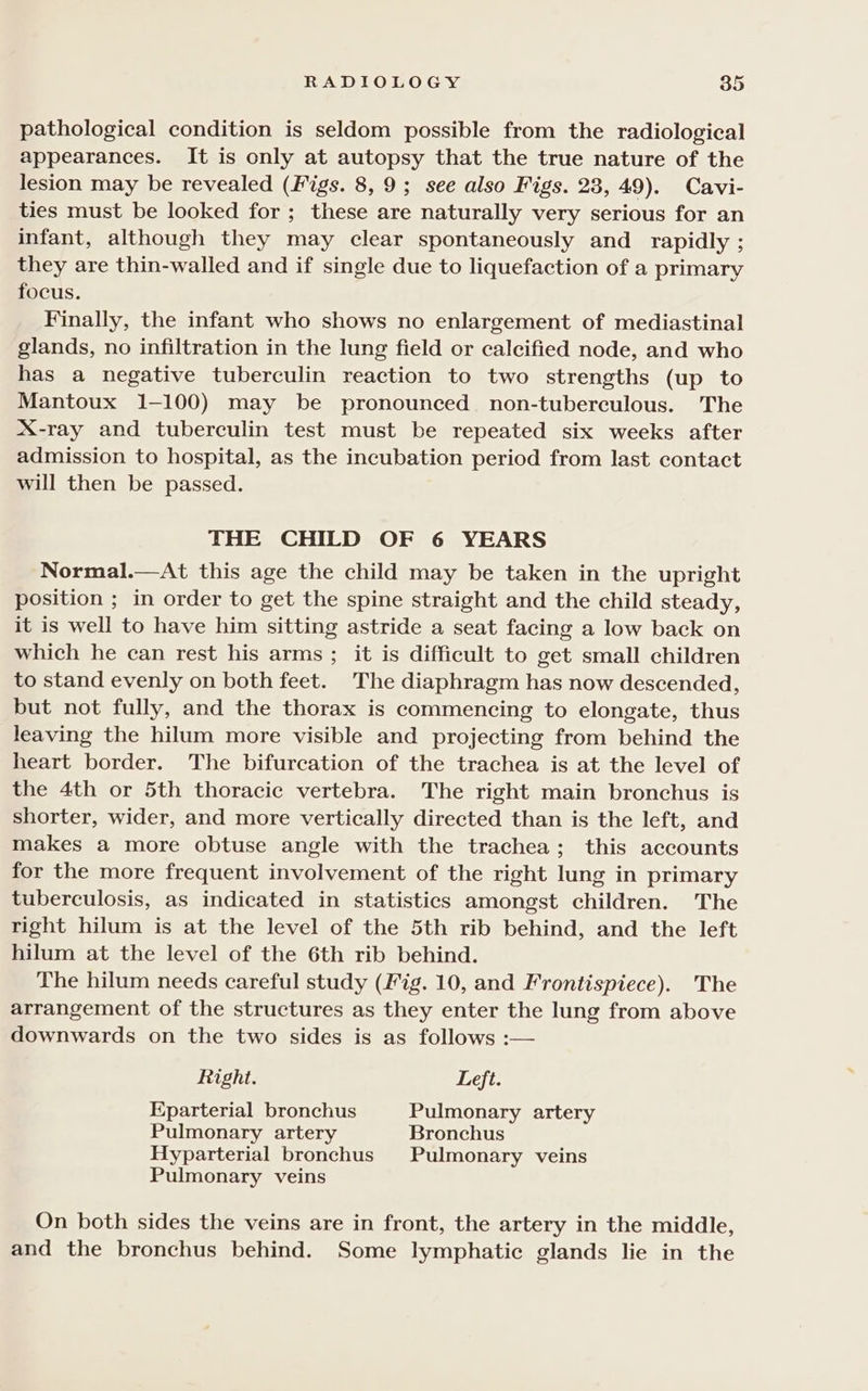 pathological condition is seldom possible from the radiological appearances. It is only at autopsy that the true nature of the lesion may be revealed (Figs. 8, 9; see also Figs. 23, 49). Cavi- ties must be looked for ; these are naturally very serious for an infant, although they may clear spontaneously and_ rapidly ; they are thin-walled and if single due to liquefaction of a primary focus. Finally, the infant who shows no enlargement of mediastinal glands, no infiltration in the lung field or calcified node, and who has a negative tuberculin reaction to two strengths (up to Mantoux 1-100) may be pronounced non-tuberculous. The X-ray and tuberculin test must be repeated six weeks after admission to hospital, as the incubation period from last contact will then be passed. THE CHILD OF 6 YEARS Normal.—At this age the child may be taken in the upright position ; in order to get the spine straight and the child steady, it is well to have him sitting astride a seat facing a low back on which he can rest his arms ; it is difficult to get small children to stand evenly on both feet. The diaphragm has now descended, but not fully, and the thorax is commencing to elongate, thus leaving the hilum more visible and projecting from behind the heart border. The bifurcation of the trachea is at the level of the 4th or 5th thoracic vertebra. The right main bronchus is shorter, wider, and more vertically directed than is the left, and makes a more obtuse angle with the trachea; this accounts for the more frequent involvement of the right lung in primary tuberculosis, as indicated in statistics amongst children. The right hilum is at the level of the 5th rib behind, and the left hilum at the level of the 6th rib behind. The hilum needs careful study (Fig. 10, and Frontispiece). The arrangement of the structures as they enter the lung from above downwards on the two sides is as follows :— Right. Left. Eparterial bronchus Pulmonary artery Pulmonary artery Bronchus Hyparterial bronchus Pulmonary veins Pulmonary veins On both sides the veins are in front, the artery in the middle, and the bronchus behind. Some lymphatic glands lie in the