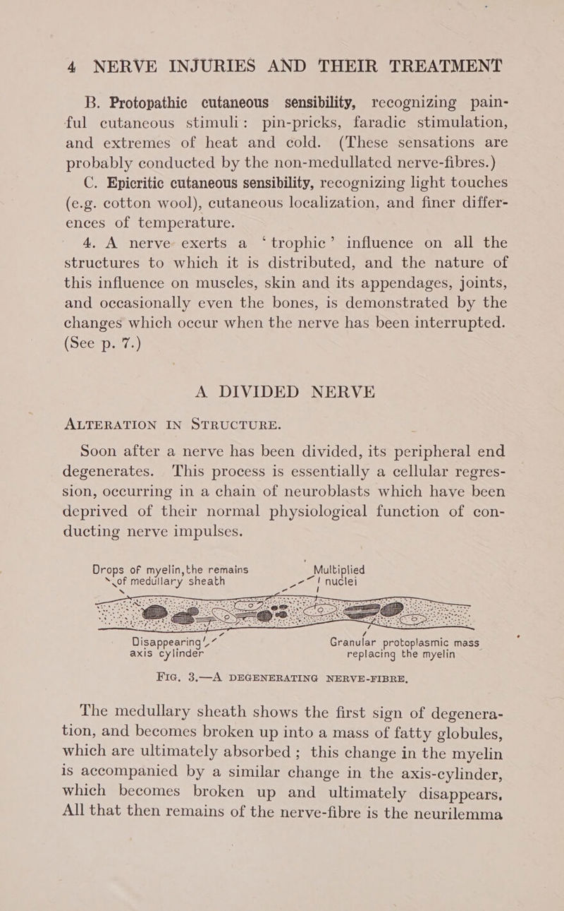 B. Protopathic cutaneous sensibility, recognizing pain- ful cutaneous stimuli: pin-pricks, faradic stimulation, and extremes of heat and cold. (These sensations are probably conducted by the non-medullated nerve-fibres. ) C. Epicritic cutaneous sensibility, recognizing light touches (e.g. cotton wool), cutaneous localization, and finer differ- ences of temperature. 4. A nerve exerts a ‘trophic’ influence on all the structures to which it is distributed, and the nature of this influence on muscles, skin and its appendages, joints, and occasionally even the bones, is demonstrated by the changes which occur when the nerve has been interrupted. (Secep ars) A DIVIDED NERVE ALTERATION IN STRUCTURE. Soon after a nerve has been divided, its peripheral end degenerates. This process is essentially a cellular regres- sion, occurring in a chain of neuroblasts which have been deprived of their normal physiological function of con- ducting nerve impulses. Drops of myelin,the remains . Multiplied ‘of medullary sheath ca nuclei “ - = = r rae / Disappearing‘ ~ Granular protoplasmic mass. axis cylinder replacing the myelin Fic, 3.—A DEGENERATING NERVE-FIBRE, The medullary sheath shows the first sign of degenera- tion, and becomes broken up into a mass of fatty globules, which are ultimately absorbed ; this change in the myelin is accompanied by a similar change in the axis-cylinder, which becomes broken up and ultimately disappears, All that then remains of the nerve-fibre is the neurilemma