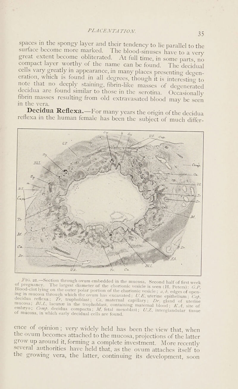 spaces in the spongy layer and their tendency to lie parallel to the surface become more marked. The blood-sinuses have to a very great extent become obliterated. At full time, in some parts, no compact layer worthy of the name can be found. The decidual cells vary greatly in appearance, in many places presenting degen- eration, which is found in all degrees, though it is interesting to note that no deeply staining, fibrin-like masses of degenerated decidua are found similar to those in the serotina. Occasionally fibrin masses resulting from old extravasated blood may be seen in. the vera. Decidua Reflexa.—For many years the origin of the decidua reflexa in the human female has been the subject of much differ- FIG. 21.—Section through ovum embedded in the mucosa, Second half of first week of pregnancy. The largest diameter of the chorionic vesicle 1s seen (HH. Peters): GP Blood-clot lying on the outer polar portion of the chorionic vesicle; a,.d, edges of open- ing in mucosa through which the ovum has excavated; U7. &, uterine epithelium ; Cap, decidua reflexa; 7y, trophoblast; Ca, maternal capillary; Dr, gland of uterine mucosa; #/.Z, lacune in the trophoblast, containing maternal blood; A.A, site of embryo; Comp, decidua compacta; M, fetal mesoblast; U.Z, interglandular tissue of mucosa, in which early decidual cells are found. ence of opinion; very widely held has been the view that, when the ovum becomes attached to the mucosa, projections of the latter sTow up around it, forming a complete investment. More recently several authorities have held that, as the ovum attaches itself to the growing vera, the latter, continuing its development, soon