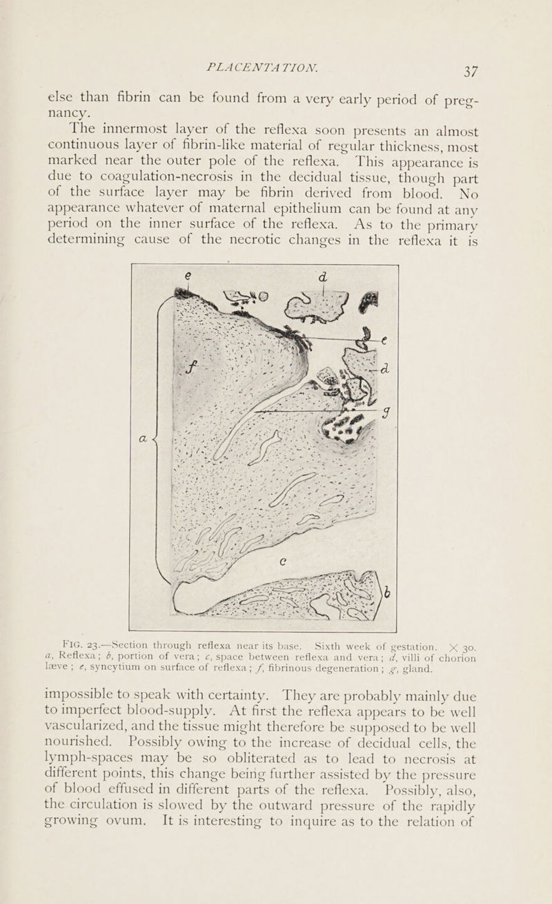 else than fibrin can be found from a very early period of preg- nancy. The innermost layer of the reflexa soon presents an almost continuous layer of fibrin-like material of regular thickness, most marked near the outer pole of the reflexa. This appearance is due to coagulation-necrosis in the decidual tissue, though part of the surface layer may be fibrin derived from blood. No appearance whatever of maternal epithelium can be found at any period on the inner surface of the reflexa. As to the primary determining cause of the necrotic changes in the reflexa it is FIG. 23.—Section through reflexa near its base. Sixth week of gestation. 30. a, Reflexa; 4, portion of vera; c, space between reflexa and vera; d, villi of chorion leeve ; e, syncytium on surface of reflexa; /, fibrinous degeneration ; £, gland. impossible to speak with certainty. They are probably mainly due to imperfect blood-supply. At first the reflexa appears to be well vascularized, and the tissue might therefore be supposed to be well nourished. Possibly owing to the increase of decidual cells, the lymph-spaces may be so obliterated as to lead to necrosis at different points, this change being further assisted by the pressure of blood effused in different parts of the reflexa. Possibly, also, the circulation is slowed by the outward pressure of the rapidly growing ovum. It is interesting to inquire as to the relation of