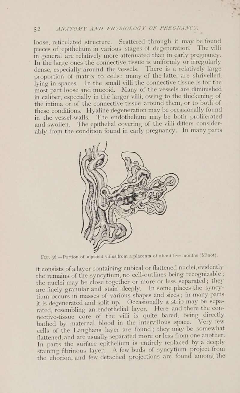 loose, reticulated structure. Scattered through it may be found pieces of epithelium in various stages of degeneration. The villi in general are relatively more attenuated than in early pregnancy. In the large ones the connective tissue is uniformly or irregularly dense, especially around the vessels. There is a relatively large proportion of matrix to cells; many of the latter are shrivelled, lying in spaces. In the small villi the connective tissue is for the most part loose and mucoid. Many of the vessels are diminished in caliber, especially in the larger villi, owing to the thickening of the intima or of the connective tissue around them, or to both of these conditions. Hyaline degeneration may be occasionally found in the vessel-walls. The endothelium may be both proliferated and swollen. The epithelial covering of the villi differs consider- ably from the condition found in early pregnancy. In many parts FIG. 36.—Portion of injected villus from a placenta of about five months (Minot). it consists of a layer containing cubical or flattened nuclei, evidently the remains of the syncytium, no cell-outlines being recognizable ; the nuclei may be close together or more or less separated ; they are finely granular and stain deeply. In some places the syncy- tium occurs in masses of various shapes and sizes; in many parts it is degenerated and split up. Occasionally a strip may be sepa- rated, resembling an endothelial layer. Here and there the con- nective-tissue core of the villi is quite bared, being directly bathed by maternal blood in the intervillous space. Very few cells of the Langhans layer are found; they may be somewhat flattened, and are usually separated more or less from one another. In parts the surface epithelium is entirely replaced by a deeply staining fibrinous layer. A few buds of syncytium project from the chorion, and few detached projections are found among the