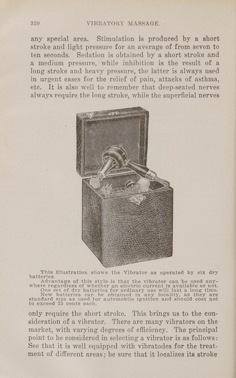 any special area. Stimulation is produced by a short stroke and light pressure for an average of from seven to ten seconds. Sedation is obtained by a short stroke and a medium pressure, while inhibition is the result of a long stroke and heavy pressure, the latter is always used in urgent cases for the relief of pain, attacks of asthma, ete. It is also well to remember that deep-seated nerves always require the long stroke, while the superficial nerves This illustration shows the Vibrator as operated by six dry batteries. Advantage of this style is that the vibrator can be used any- where regardless of whether an electric current is available or not. One set of dry batteries for ordinary use will last a long time. New batteries car be obtained in any locality, as they are standard size as used for automobile ignition and should cost not to exceed 25 cents each. only require the short stroke. This brings us to the con- sideration of a vibrator. There are many vibrators on the market, with varying degrees of efficiency. The principal point to be considered in selecting a vibrator is as follows: See that it is well equipped with vibratodes for the treat- ment of different areas; be sure that it localizes its stroke