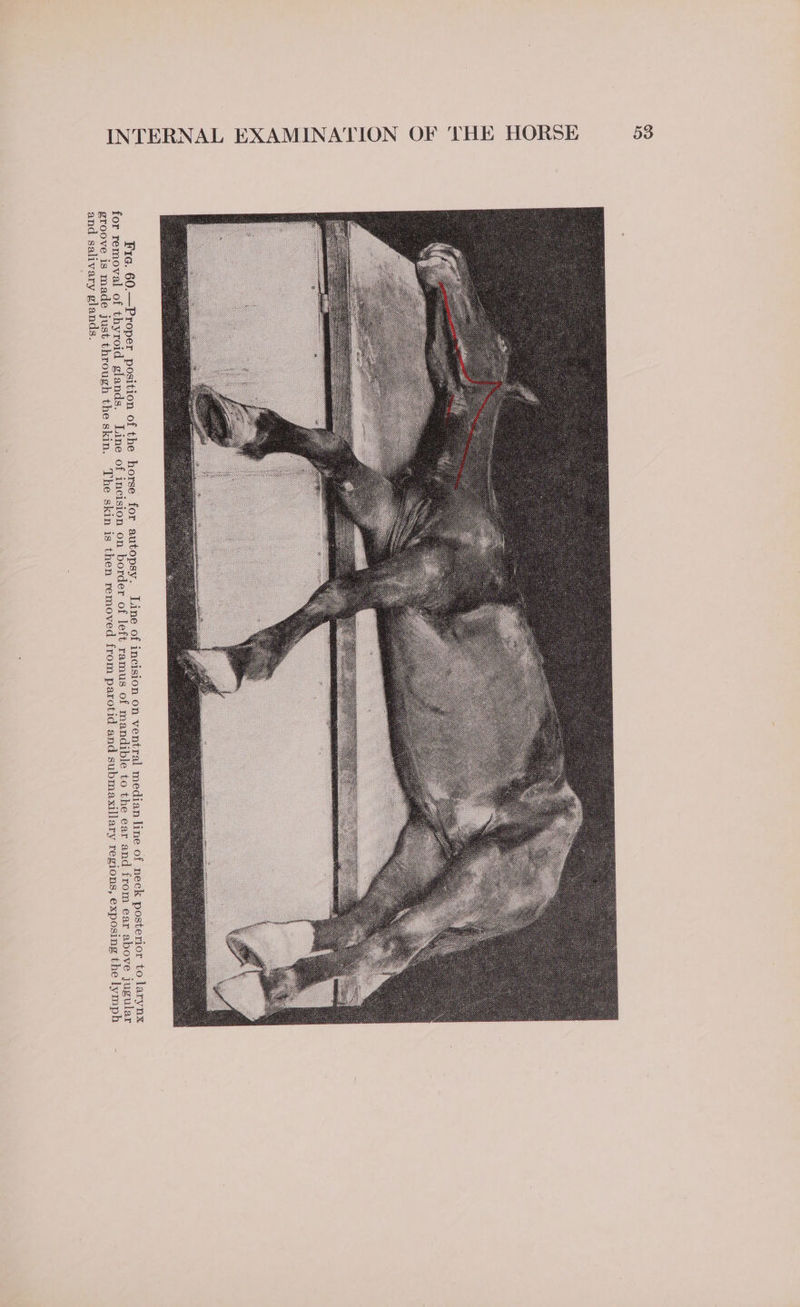 Fic. 60.—Proper position of the for removal of thyroid glands. Line groove is made just through the skin. and salivary glands. of incision on border of left ramus of mandi ble to the ear and from ear above jugular