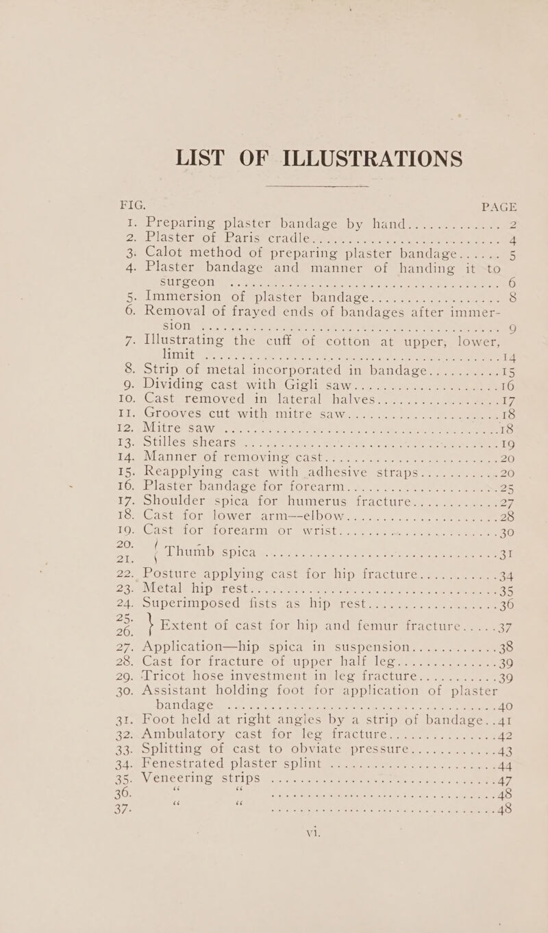 LIST OF ILLUSTRATIONS FIG. PAGE i Preparing vplaster bandace by Nanda ewe 2 2 AS error Lan iswicrd | Ceaee e vaaeee, Sar Oem: ae 4 3: Calot method or preparing plaster bandawe.. 124. 5 4. Plaster bandage and manner of handing it to SMR SOR 9.’ . meet aetag ea cette Pht ee ae ee tea 6 Re LIMmMersion -O1 splastorepandace ~ 4.8. oo eee 8 6. Removal of frayed ends of bandages after immer- BLOT asec eet ote od eR ee iy tse ee ) 7. Illustrating the cuff of cotton at upper, lower, AV aC sate Reng ae My ee AT Ba ie RON ee We es) 14 S. otfip Of inetal incorporated an bandase. 9... 15 Oy Dividing. cast with’ Gisltesawe:.. 6 en eee 16 10, Cast’ removed in, lateral halves. 3:0 eee 17 TL GrOOV eSiClUewitlm tlt teaca wees ee eta ee eee Ap PoP TERS AW peor retrain tavern ac tat ae ee ee ee 18 oeotillesyenearsen. vache eh wel ee Oe ae ee eee 19 14. Manner of removing cast. eens es RNB ee 15, Reapplyine cast with adhesiv e straps. LS ee 16. Plasvertbandase tor forearm: o. 5 y. eel ees 25 L7-ohouldersspical fOr miuimerts. Iracturec.. eee 27 1OseG Aste ror doweraatm==clbOWw... 4... 0 eee 28 LOM Caste ToretOrearim. Of @wilist 40 ise nose 2 eee ee 30 a Wiihard ia cieitet on eae ei re se oe Eyl gee Pastirewapplyingecas’ Lor Hip iractires see wee 34 See Vietale hiperesiae hi atl ek re Ve eee 35 PA OUPETIMpOsed Miss aewliipareet jail |i eee neat ge \ Hatent Giecastaor hip and ienuriracture. 1 - es 27. Application—hip spica in suspension............ 38 26. Cast tor irdeture Olemp per Gali co eee eee 39 29. ‘Tricot hose investment in leg fracture. ae eee 30. Assistant holding foot for application of plaster Dan dae ee at Settee ee a eee Ah can) OU nae 40 31. Foot held at right angles by a strip of bandage. .41 2a ~Ambulatorys cast [or Hee riracture, rs, eee 42 S3ceOPULIINS tOre CAStN tO) Gl Vid temp) corll Cera. ane ape JALMLeIves trated yp l aster ss piidieeee eee a ee AA SAV EN CENT OOStTING ., Gea Seen een la ae 47 aU +s Tia Sey eB Ree ALG Ot eV. oe ae 48 oe a ne ale et pte Rt, ae ene, oh et 48