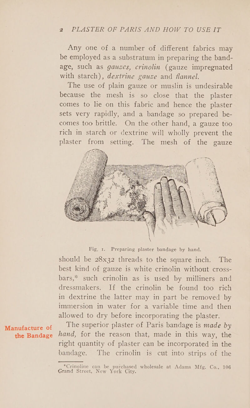 Manufacture of the Bandage 2° (RPLUASTEIROOR PA eA Dn OMe O. US Het Any one of a number of different fabrics may be employed as a substratum in preparing the band- age, such as gauzes, crinolin (gauze impregnated with starch), dextrine gauze and flannel. The use of plain gauze or muslin is undesirable because the mesh is so close that the plaster comes to lie on this fabric and hence the plaster sets very rapidly, and a bandage so prepared be- comes too brittle. On the other hand, a gauze too rich in starch or dextrine will wholly prevent the plaster from setting. The mesh of the gauze should be 28x32 threads to the square inch. The best kind of gauze is white crinolin without cross- bars,* such crinolin as is used by milliners and dressmakers. If the crinolin be found too rich in dextrine the latter may in part be removed by immersion in water for a variable time and then allowed to dry before incorporating the plaster. The superior plaster of Paris bandage is made by hand, for the reason that, made in this way, the right quantity of plaster can be incorporated in the bandage. The crinolin is cut into strips of the *Crinoline can be purchased wholesale at Adams Mfg. Co., 106 Grand Street, New York City.