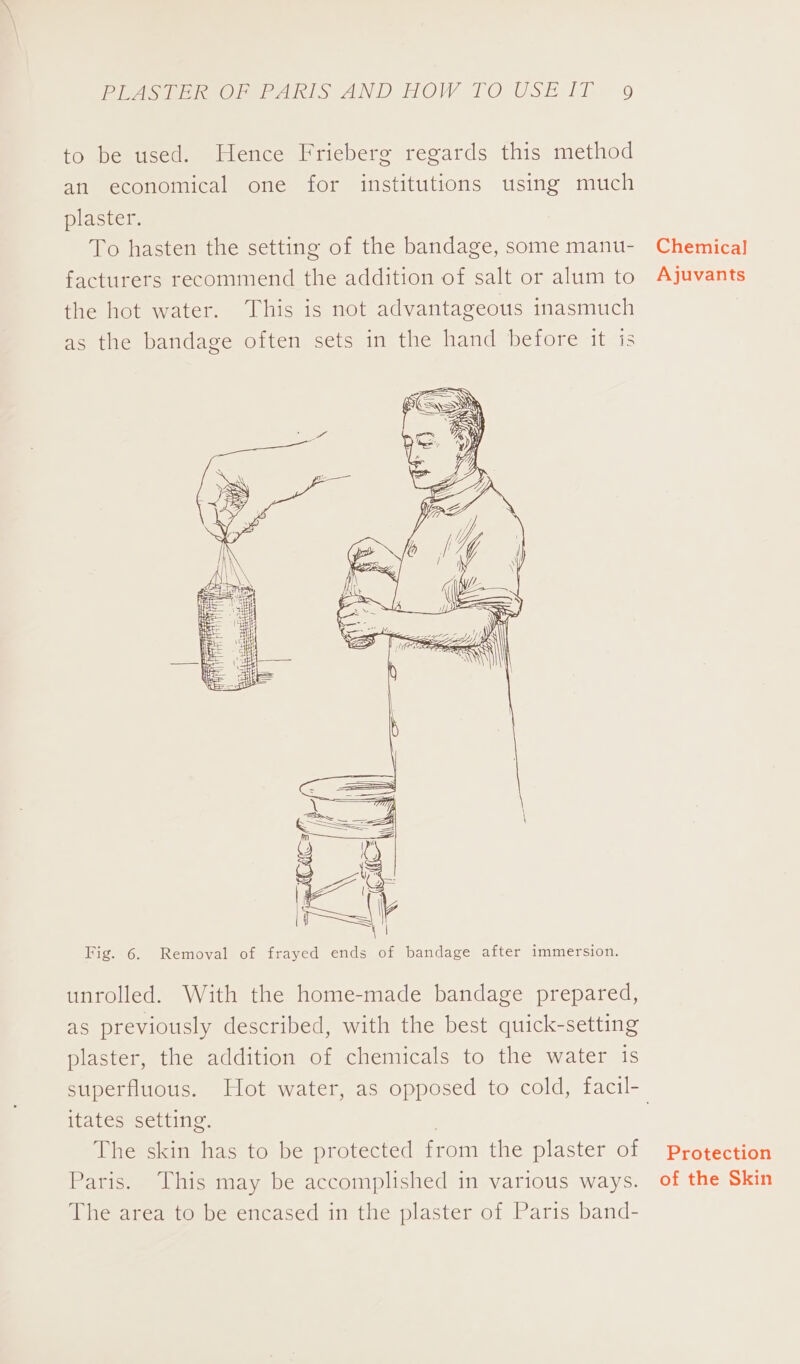 to be used. Hence Friebere regards this method an economical one for institutions using much plaster. To hasten the setting of the bandage, some manu- facturers recommend the addition of salt or alum to the hot water. This is not advantageous inasmuch as the bandage often sets in the hand before it is Fig. 6. Removal of frayed ends of bandage after immersion. unrolled. With the home-made bandage prepared, as previously described, with the best quick-setting plaster, the addition of chemicals to the water is itates setting. } The skin has to be protected from the plaster of Paris. This may be accomplished in various ways. The area to be encased in the plaster of Paris band- Chemical] Ajuvants Protection of the Skin