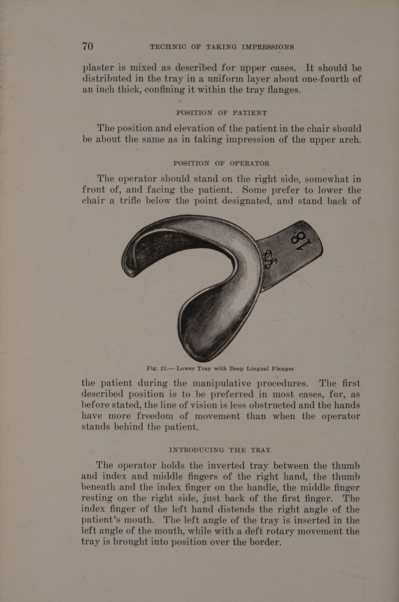 plaster is mixed as described for upper cases. It should be distributed in the tray in a uniform layer about one-fourth of an inch thick, confining it within the tray flanges. POSITION OF PATIENT The position and elevation of the patient in the chair should be about the same as in taking impression of the upper arch. POSITION OF OPERATOR The operator should stand on the right side, somewhat in front of, and facing the patient. Some prefer to lower the chair a trifle below the point designated, and stand back of the patient during the manipulative procedures. The first described position is to be preferred in most cases, for, as before stated, the line of vision is less obstructed and the hands have more freedom of movement than when the operator stands behind the patient. INTRODUCING THE TRAY The operator holds the inverted tray between the thumb and index and middle fingers of the right hand, the thumb beneath and the index finger on the handle, the middle finger resting on the right side, just back of the first finger. The index finger of the left hand distends the right angle of the patient’s mouth. The left angle of the tray is inserted in the left angle of the mouth, while with a deft rotary movement the tray is brought into position over the border.