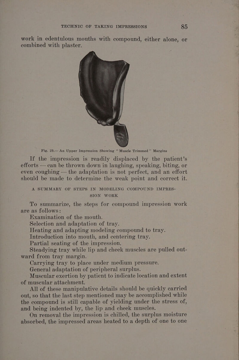 work in edentulous mouths with compound, either alone, or combined with plaster. Fig. 29.— An Upper Impression Showing ‘‘ Muscle Trimmed ” Margins If the impression is readily displaced. by the patient’s efforts — can be thrown down in laughing, speaking, biting, or even coughing — the adaptation is not perfect, and an effort should be made to determine the weak point and correct it. A SUMMARY OF STEPS IN MODELING COMPOUND IMPRES- SION WORK To summarize, the steps for compound impression work are as follows: Kxamination of the mouth. Selection and adaptation of tray. Heating and adapting modeling compound to tray. Introduction into mouth, and centering tray. Partial seating of the impression. Steadying tray while lip and cheek muscles are pulled out- ward from tray margin. Carrying tray to place under medium pressure. General adaptation of peripheral surplus. Muscular exertion by patient to indicate location and extent of muscular attachment. | All of these manipulative details should be quickly carried out, so that the last step mentioned may be accomplished while the compound is still capable of yielding under the stress of, and being indented by, the lip and cheek muscles. On removal the impression is chilled, the surplus moisture absorbed, the impressed areas heated to a depth of one to one