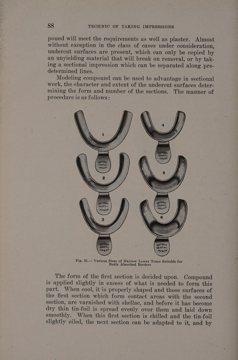 pound will meet the requirements as well as plaster. Almost without exception in the class of cases under consideration, undercut surfaces are present, which can only be copied by an unyielding material that will break on removal, or by tak- ing a sectional impression which can be separated along pre- determined lines. Modeling compound can be used to advantage in sectional work, the character and extent of the undercut surfaces deter- mining the form and number of the sections. The manner of procedure is as follows: The form of the first section is decided upon. Compound is applied slightly in excess of what is needed to form this part. When cool, it is properly shaped and those surfaces of the first section Sant form contact areas with the second section, are varnished with shellac, and before it has become dry thin tin-foil is spread evenly over them and laid down smoothly. When this first section is chilled and the tin-foil slightly oiled, the next section can be adapted to it, and by