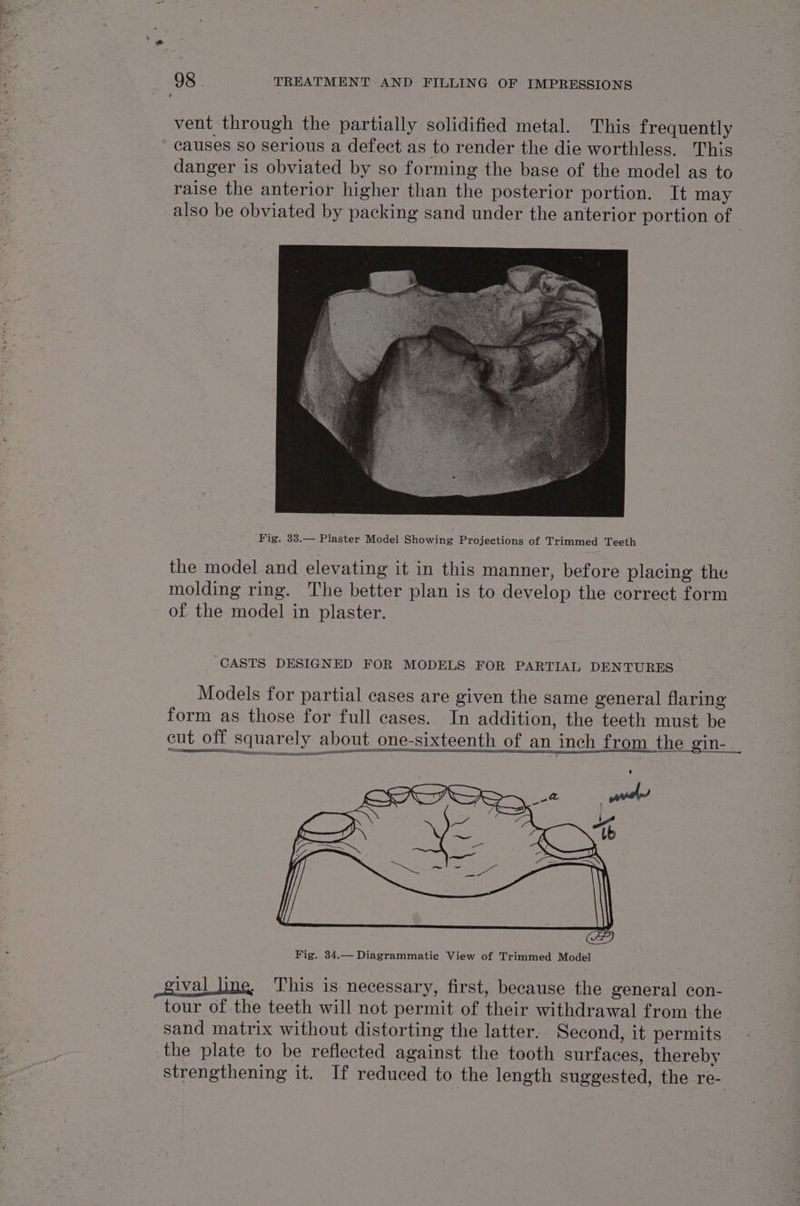 vent through the partially solidified metal. This frequently causes so serious a defect as to render the die worthless. This danger is obviated by so forming the base of the model as to raise the anterior higher than the posterior portion. It may also be obviated by packing sand under the anterior portion of Fig. 33.— Plaster Model Showing Projections of Trimmed Teeth the model and elevating it in this manner, before placing the molding ring. The better plan is to develop the correct form of the model in plaster. ‘CASTS DESIGNED FOR MODELS FOR PARTIAL DENTURES Models for partial cases are given the same general flaring form as those for full cases. In addition, the teeth must be cut off squarely about one-sixteenth of an inch from the gin- ival line, This is necessary, first, because the general con- tour of the teeth will not permit of their withdrawal from the sand matrix without distorting the latter. Second, it permits the plate to be reflected against the tooth surfaces, thereby strengthening it. If reduced to the length suggested, the re-