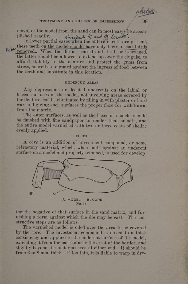 / moval of the model from the sand can in most cases’ be accom- plished readily. PSY ODS he ety ; In lower partial cases when ne anterior teeth are present, ave these teeth on the model should have only their incisal thirds removed., When the die is secured and the base is swaged, the latter should be allowed to extend up over the cingule, to afford stability to the denture and protect the gums from stress, as well as to guard against the ingress of food between the teeth and substitute in this location. UNDERCUT AREAS Any depressions or decided undercuts on the labial or buceal surfaces of the model, not involving areas covered by the denture, can be eliminated by filling in with plaster or hard wax and giving such surfaces the proper flare for withdrawal] from the matrix. The outer surfaces, as yall as the bases of models, should be finished with fine and paper to render them smooth, and the entire model varnished with two or three coats of shellac evenly applied. 7 CORES A core is an addition of investment compound, or some refractory material, which, when built against an undercut surface on a model and properly trimmed, is used for develop _ ing the negative of that surface in the sand matrix, and fur- nishing a form against which the die may be east. The con- structive steps are as follows: _ he varnished model is oiled over the area to be covered by the core. The investment compound is mixed to a thick consistency and applied to the undercut surface of the model, — extending it from the base to near the crest of the border, and slightly beyond the undercut area at either end. It should be from 6 to 8 mm. thick. If too thin, it is liable to warp in dry-