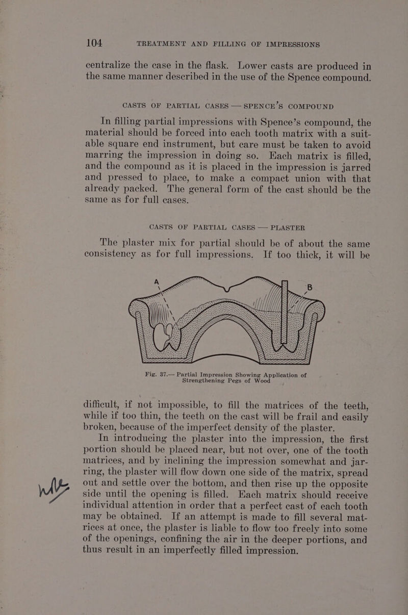 \ centralize the case in the flask. Lower casts are produced in the same manner described in the use of the Spence compound. CASTS OF PARTIAL CASES — SPENCE’S COMPOUND In filling partial impressions with Spence’s compound, the material should be forced into each tooth matrix with a suit- able square end instrument, but care must be taken to avoid marring the impression in doing so. Each matrix is filled, and the compound as it is placed in the impression is jarred and pressed to place, to make a compact union with that already packed. The general form of the cast should be the same as for full cases. CASTS OF PARTIAL CASES — PLASTER The plaster mix for partial should be of about the same consistency as for full impressions. If too thick, it will be difficult, if not impossible, to fill the matrices of the teeth, while if too thin, the teeth on the cast will be frail and easily broken, because of the imperfect density of the plaster. In introducing the plaster into the impression, the first portion should be placed near, but not over, one of the tooth matrices, and by inclining the impression somewhat and jar- ring, the plaster will flow down one side of the matrix, spread out and settle over the bottom, and then rise up the opposite side until the opening is filled. Each matrix should receive individual attention in order that a perfect cast of each tooth may be obtained. If an attempt is made to fill several mat- rices at once, the plaster is liable to flow too freely into some of the openings, confining the air in the deeper portions, and thus result in an imperfectly filled impression.