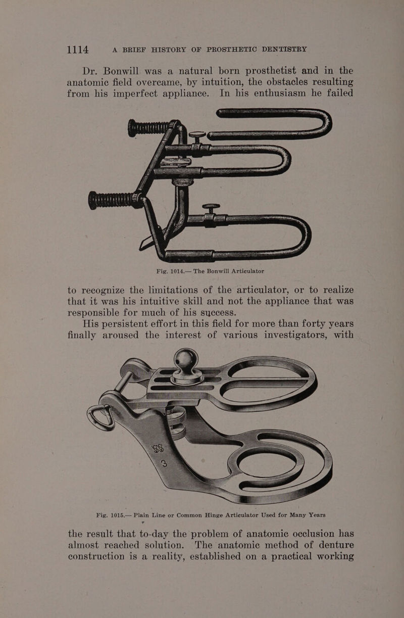 Dr. Bonwill was a natural born prosthetist and in the anatomic field overcame, by intuition, the obstacles resulting from his imperfect appliance. In his enthusiasm he failed Fig. 1014.— The Bonwill Articulator to recognize the limitations of the articulator, or to realize that it was his intuitive skill and not the appliance that was responsible for much of his success. His persistent effort in this field for more than forty years finally aroused the interest of various investigators, with the result that to-day the problem of anatomic occlusion has almost reached solution. The anatomic method of denture construction is a reality, established on a practical working