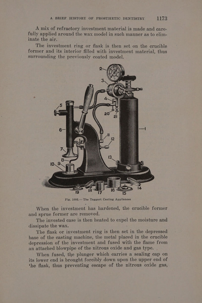 A mix of refractory investment material is made and care- fully applied around the wax model in such manner as to elim- inate the air. | The investment ring or flask is then set on the crucible former and its interior filled with investment material, thus surrounding the previously coated model. When the investment has hardened, the crucible former and sprue former are removed. The invested case is then heated to pene the moisture and dissipate the wax. ‘The fask or investment ring is then set in the depressed base of the casting machine, the metal placed in the crucible depression of the investment and fused with the flame from an attached blowpipe of the nitrous oxide and gas type. When fused, the plunger which carries a sealing cap on its lower end is brought forcibly down upon the upper end of the flask, thus preventing escape of the nitrous oxide gas,