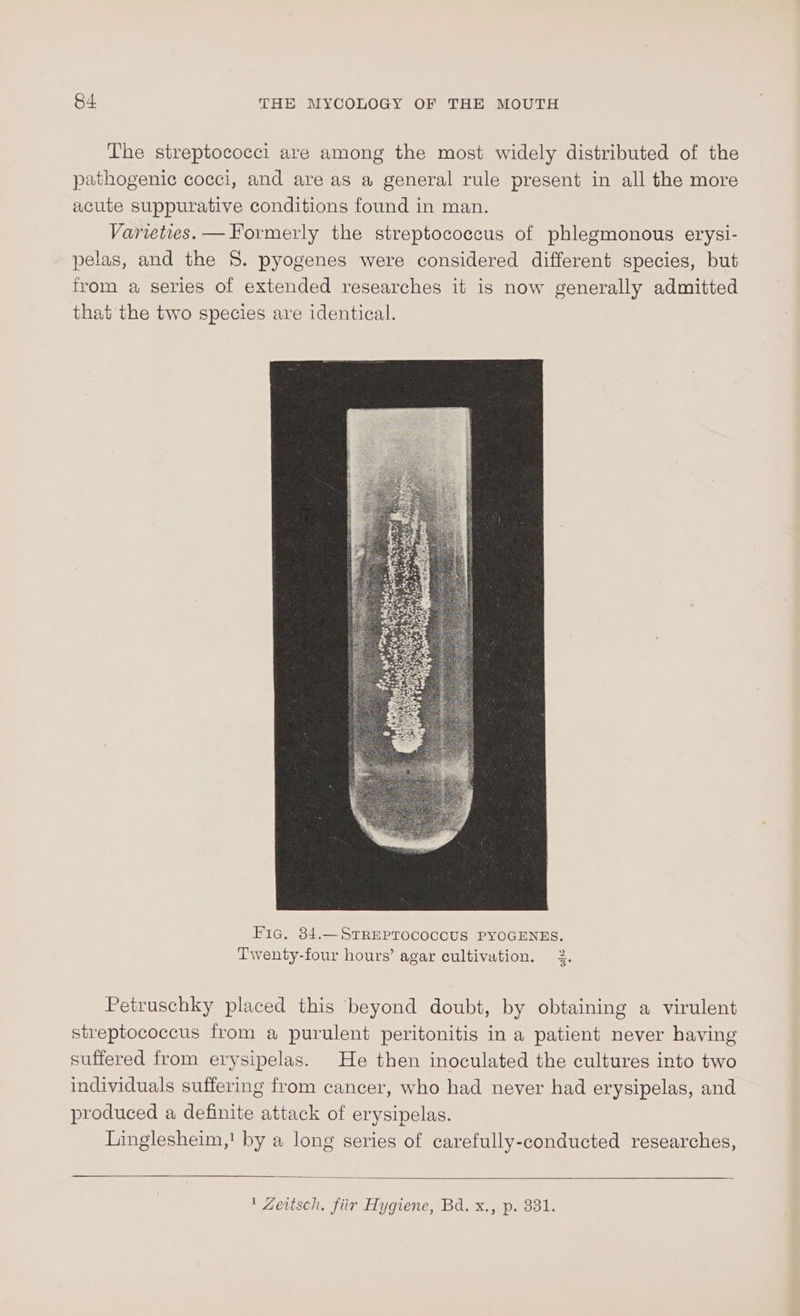 Lhe streptococci are among the most widely distributed of the pathogenic cocci, and are as a general rule present in all the more acute suppurative conditions found in man. Varieties. —Formerly the streptococcus of phlegmonous erysi- pelas, and the 8. pyogenes were considered different species, but from a series of extended researches it is now generally admitted that the two species are identical. Fig, 84.—SrREPTococcUS PYOGENES. Twenty-four hours’ agar cultivation. 2. Petruschky placed this beyond doubt, by obtaining a virulent streptococcus from a purulent peritonitis in a patient never having suffered from erysipelas. He then inoculated the cultures into two individuals suffering from cancer, who had never had erysipelas, and produced a definite attack of erysipelas. Linglesheim,' by a long series of carefully-conducted researches, ' Zeitsch. fiir Hygiene, Bd. x., p. 331.