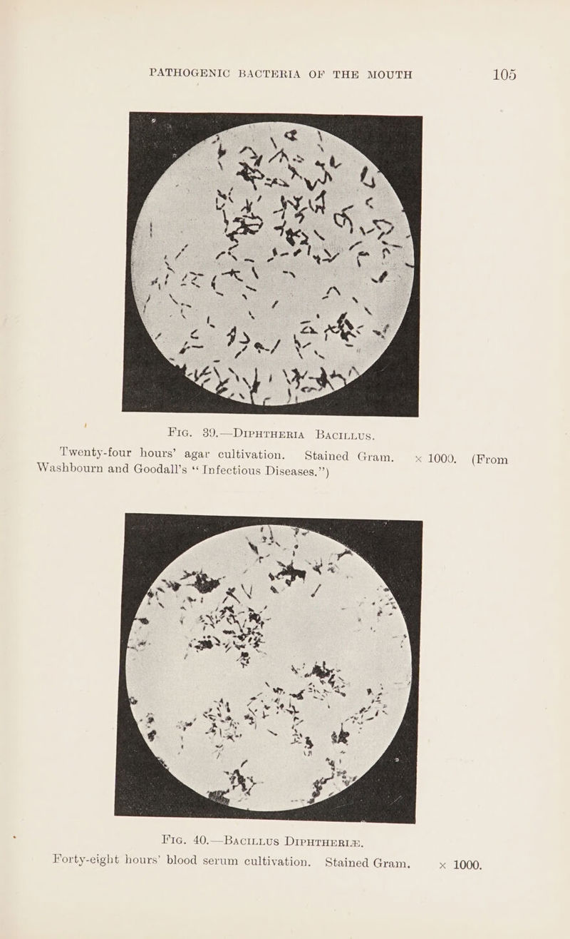 Fic. 39,—DimpHTHeEerRia BaAcILLus. Twenty-four hours’ agar cultivation. Stained Gram. x 1009, (From Washbourn and Goodall’s * Infectious Diseases.”’)