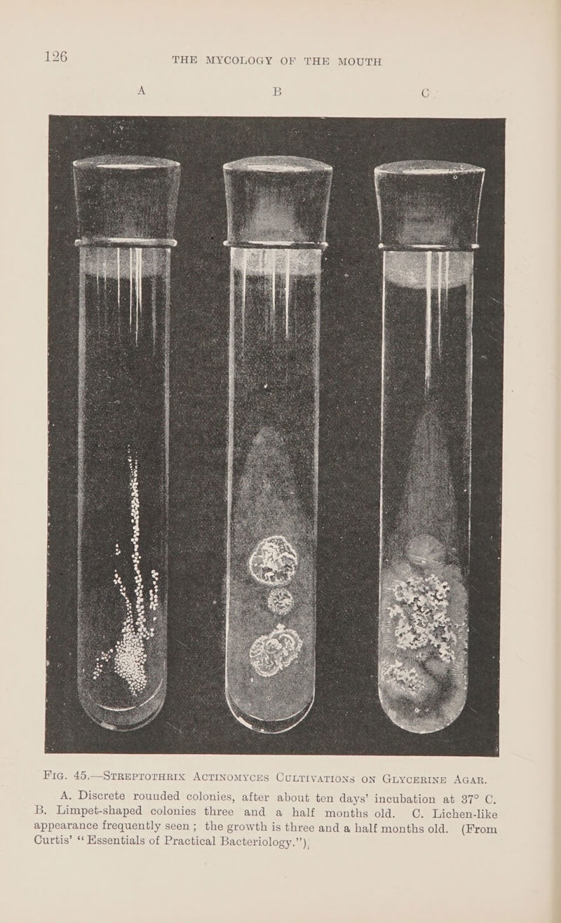 ey bet weer. nih einaahs cb socbinaliallcabiddes oes ‘a%e°ay ae asta Fic. 45.—STREPTOTHRIX ACTINOMYCES CULTIVATIONS ON GLYCERINE AGAR. A. Discrete rounded colonies, after about ten days’ incubation at 37° C. B, Limpet-shaped colonies three and a half months old. OG. Lichen-like appearance frequently seen; the growth is three and a half months old. (From Curtis’ ‘‘ Essentials of Practical Bacteriology.”