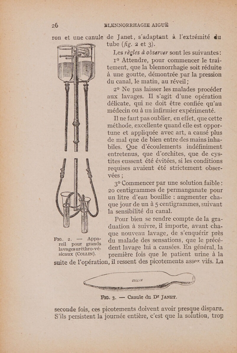 ron et une canule de Janet, s'adaptant à l'extrémité du ae tube (fig. 2 et 3). Les règles à observer sont les suivantes: 10 Attendre, pour commencer le trai- tement, que la blennorrhagie soit réduite à une goutte, démontrée par la pression du canal, le matin, au réveil: 29 Ne pas laisser les malades procéder aux lavages. Il s’agit d’une opération délicate, qui ne doit être confiée qu’au médecin ou à un infirmier expérimenté. 1 ne faut pas oublier, en effet, que cette méthode, excellente quand elle est oppor- tune et appliquée avec art, a causé plus de mal que de bien entre des mains inha- biles. Que d’écoulements indéfiniment entretenus, que d’orchites, que de cys- tites eussent été évitées, si les conditions requises avaient été strictement obser- vées ; 3° Commencer par une solution faible : 20 centigrammes de permanganate pour un litre d’eau bouillie ; augmenter cha- que jour de un à 5 centigrammes, suivant la sensibilité du canal. Pour bien se rendre compte de la gra- duation à suivre, il importe, avant cha- que nouveau lavage, de s'enquérir près FIG. 2. — APPa- du malade des sensations, que le précé- reil pour grands à : HT lavagesuréthro-vé- dent lavage lui a causées. En général, la sicaux (COLLIN). première fois que le patient urine à la suite de l'opération, il ressent des picotements assez. vifs. La DAS CUITS SRE EE { CoLLIN seconde fois, ces picotements doivent avoir presque disparu. S'ils persistent la journée entière, c'est que la solution, trop