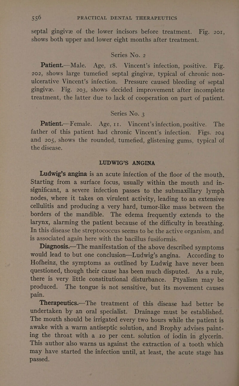 septal gingive of the lower incisors before treatment. Fig. 201, shows both upper and lower eight months after treatment. Series No. 2 Patient.—Male. Age, 18. Vincent’s infection, positive. Fig. 202, shows large tumefied septal gingive, typical of chronic non- ulcerative Vincent’s infection. Pressure caused bleeding of septal gingive. Fig. 203, shows decided improvement after incomplete treatment, the latter due to lack of cooperation on part of patient. Series No. 3 Patient.—Female. Age, 11. Vincent’s infection, positive. The father of this patient had chronic Vincent’s infection. Figs. 204 and 205, shows the rounded, tumefied, glistening gums, typical of the disease. LUDWIG’S ANGINA | Ludwig’s angina is an acute infection of the floor of the mouth. Starting from a surface focus, usually within the mouth and in- significant, a severe infection passes to the submaxillary lymph nodes, where it takes on virulent activity, leading to an extensive cellulitis and producing a very hard, tumor-like mass between the borders of the mandible. The edema frequently extends to the larynx, alarming the patient because of the difficulty in breathing. In this disease the streptococcus seems to be the active organism, and is associated again here with the bacillus fusiformis. Diagnosis.—The manifestation of the above described symptoms would lead to but one conclusion—Ludwig’s angina. According to Hofheinz, the symptoms as outlined by Ludwig have never been questioned, though their cause has been much disputed. As a rule, there is very little constitutional disturbance. Ptyalism may be produced. The tongue is not sensitive, but its movement causes pain. Therapeutics.—The treatment of this disease had better be undertaken by an oral specialist. Drainage must be established. The mouth should be irrigated every two hours while the patient is awake with a warm antiseptic solution, and Brophy advises paint- ing the throat with a so per cent. solution of iodin in glycerin. This author also warns us against the extraction of a tooth which may have started the infection until, at least, the acute stage has passed.