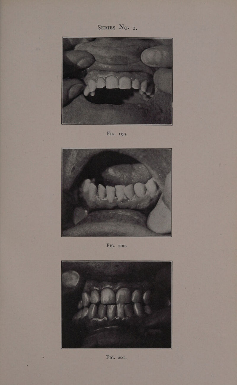 FIG. 199. FIG. 200. FIG. S261.