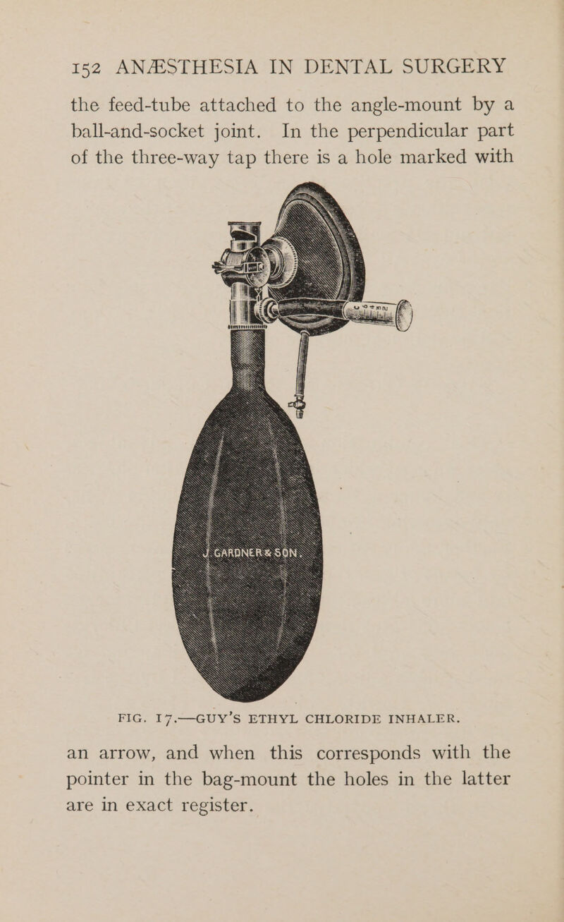 the feed-tube attached to the angle-mount by a ball-and-socket joint. In the perpendicular part of the three-way tap there is a hole marked with FIG, 17.—GUY’S ETHYL CHLORIDE INHALER. an arrow, and when this corresponds with the pointer in the bag-mount the holes in the latter are in exact register.