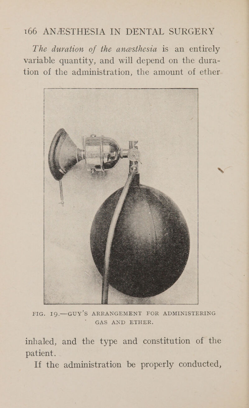 The duration of the anesthesia is an entirely variable quantity, and will depend on the dura- tion of the administration, the amount of ether FIG, I9.—GUY’S ARRANGEMENT FOR ADMINISTERING GAS AND ETHER. inhaled, and the type and constitution of the patient. If the administration be properly conducted,