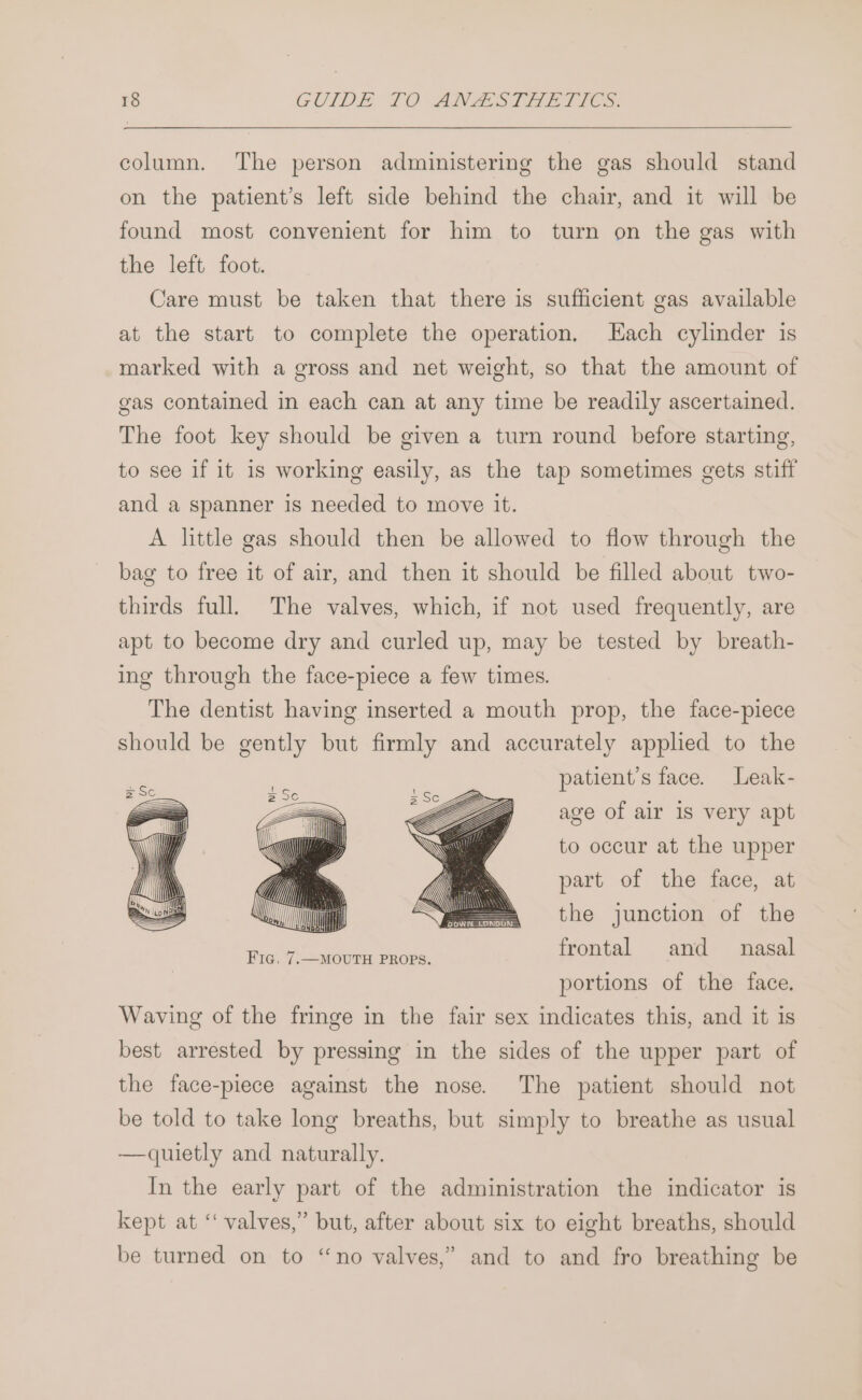 column. The person administering the gas should stand on the patient’s left side behind the chair, and it will be found most convenient for him to turn on the gas with the left foot. Care must be taken that there is sufficient gas available at the start to complete the operation, Each cylinder is marked with a gross and net weight, so that the amount of gas contained in each can at any time be readily ascertained. The foot key should be given a turn round before starting, to see if it is working easily, as the tap sometimes gets stiff and a spanner is needed to move it. A little gas should then be allowed to flow through the bag to free it of air, and then it should be filled about two- thirds full. The valves, which, if not used frequently, are apt to become dry and curled up, may be tested by breath- ing through the face-piece a few times. The dentist having inserted a mouth prop, the face-piece should be gently but firmly and accurately applied to the patient’s face. Leak- age of air 1s very apt to occur at the upper part of the face, at the junction of the frontal and nasal portions of the face. Waving of the fringe in the fair sex indicates this, and it is best arrested by pressing in the sides of the upper part of the face-piece against the nose. The patient should not be told to take long breaths, but simply to breathe as usual —quietly and naturally. In the early part of the administration the indicator is kept at ‘ valves,” but, after about six to eight breaths, should be turned on to ‘no valves,” and to and fro breathing be