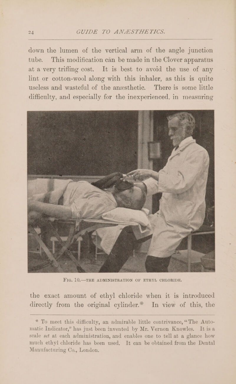 down the lumen of the vertical arm of the angle junction tube. This modification can be made in the Clover apparatus at a very trifling cost. It is best to avoid the use of any lint or cotton-wool along with this inhaler, as this is quite useless and wasteful of the anesthetic. There is some little difficulty, and especially for the inexperienced, in measuring the exact amount of ethyl chloride when it is introduced directly from the original cylinder.* In view of this, the * To meet this difficulty, an admirable little contrivance, “The Auto- matic Indicator,” has just been invented by Mr. Vernon Knowles. It isa scale set at each administration, and enables one to tell at a glance how much ethyl chloride has been used. It can be obtained from the Dental Manufacturing Co., London.