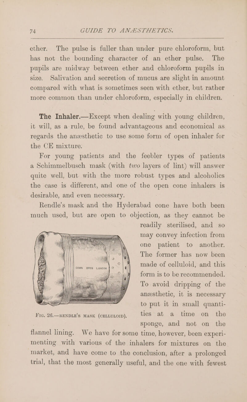 ether. The pulse is fuller than under pure chloroform, but has not the bounding character of an ether pulse. The pupils are midway between ether and chloroform pupils in size. Salivation and secretion of mucus are slight in amount compared with what is sometimes seen with ether, but rather more common than under chloroform, especially in children. The Inhaler.—Except when dealing with young children, it will, as a rule, be found advantageous and economical as regards the anzsthetic to use some form of open inhaler for the CE mixture. For young patients and the feebler types of patients a Schimmelbusch mask (with two layers of lint) will answer quite well, but with the more robust types and alcoholics the case is different, and one of the open cone inhalers is desirable, and even necessary. Rendle’s mask and the ited cone have both been much used, but are open to objection, as they cannot be readily sterilised, and so may convey infection from one patient to another. The former has now been made of celluloid, and this form is to be reeommended. To avoid dripping of the anesthetic, it is necessary to put it in small quanti- Fic. 26.—RENDLE’S MASK (CELLULOID). ties at a time on the | sponge, and not on the flannel lining. We have for some time, however, been experi- menting with various of the inhalers for mixtures on the market, and have come to the conclusion, after a prolonged trial, that the most generally useful, and the one with fewest
