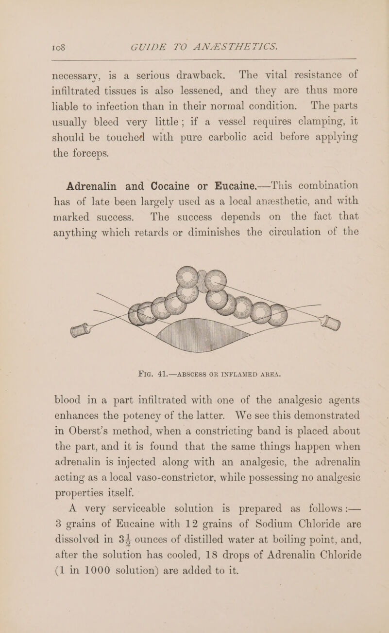 necessary, is a serious drawback. The vital resistance of infiltrated tissues is also lessened, and they are thus more liable to infection than in their normal condition. The parts g, it should be touched with pure carbolic acid before applying the forceps. usually bleed very little; if a vessel requires clampin Adrenalin and Cocaine or Eucaine——This combination has of late been largely used as a local anesthetic, and with marked success. The success depends on the fact that anything which retards or diminishes the circulation of the fF f («CC \ blood in a part infiltrated with one of the analgesic agents enhances the potency of the latter. We see this demonstrated in Oberst’s method, when a constricting band is placed about the part, and it is found that the same things happen when adrenalin is injected along with an analgesic, the adrenalin acting as a local vaso-constrictor, while possessing no analgesic properties itself. A very serviceable solution is prepared as follows :— 3 grains of Eucaine with 12 grains of Sodium Chloride are dissolved in 34 ounces of distilled water at boiling point, and, after the solution has cooled, 18 drops of Adrenalin Chloride (1 in 1000 solution) are added to it.