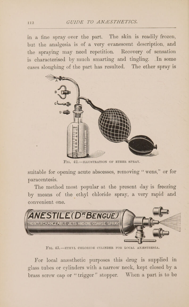 in a fine spray over the part. The skin is readily frozen, but the analgesia is of a very evanescent description, and the spraying may need repetition. Recovery of sensation is characterised by much smarting and tingling. In some cases sloughing of the part has resulted. The ether spray is Fic. 42.—ILLUSTRATION OF ETHER SPRAY. suitable for opening acute abscesses, removing ‘“ wens,” or for paracentesis. The method most popular at the present day is freezing by means of the ethyl chloride spray, a very rapid and convenient one. For local anesthetic purposes this drug is supplied in glass tubes or cylinders with a narrow neck, kept closed by a brass screw cap or “trigger” stopper. When a part is to be