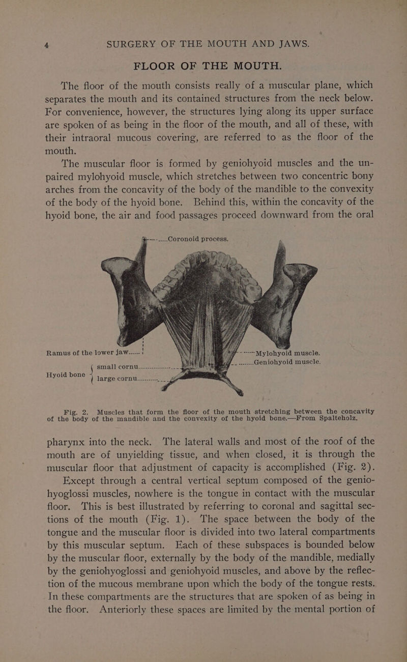 FLOOR OF THE MOUTH. The floor of the mouth consists really of a muscular plane, which separates the mouth and its contained structures from the neck below. For convenience, however, the structures lying along its upper surface are spoken of as being in the floor of the mouth, and all of these, with their intraoral mucous covering, are referred to as the floor of the mouth. The muscular floor is formed by geniohyoid muscles and the un- paired mylohyoid muscle, which stretches between two concentric bony arches from the concavity of the body of the mandible to the convexity of the body of the hyoid bone. Behind this, within the concavity of the hyoid bone, the air and food passages proceed downward from the oral -.....Coronoid process. Ramus of the lower Jaw...... ~~ Mylohyoid muscle. F } hes aritatl Coen eee ee ; _........Geniohyoid muscle Hyoid bone | large cornu..........- Fig. 2. Muscles that form the floor of the mouth stretching between the concavity of the body of the mandible and the convexity of the hyoid bone.—From §Spalteholz. pharynx into the neck. The lateral walls and most of the roof of the mouth are of unyielding tissue, and when closed, it is through the muscular floor that adjustment of capacity is accomplished (Fig. 2). Except through a central vertical septum composed of the genio- hyoglossi muscles, nowhere is the tongue in contact with the muscular floor. ‘This is best illustrated by referring to coronal and sagittal sec- tions of the mouth (Fig. 1). The space between the body of the tongue and the muscular floor is divided into two lateral compartments by this muscular septum. Each of these subspaces is bounded below by the muscular floor, externally by the body of the mandible, medially by the geniohyoglossi and geniohyoid muscles, and above by the reflec- tion of the mucous membrane upon which the body of the tongue rests. In these compartments are the structures that are spoken of as being in the floor. Anteriorly these spaces are limited by the mental portion of