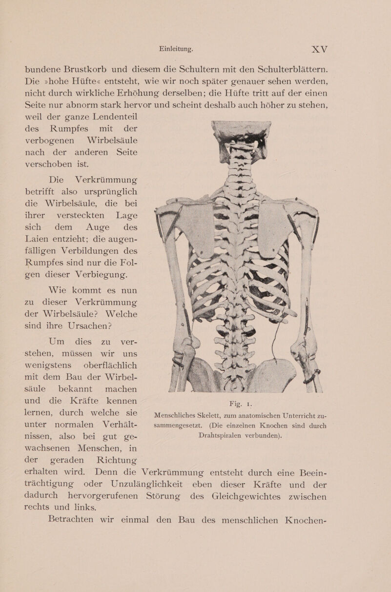 bundene Brustkorb und diesem die Schultern mit den Schulterblättern. Die »hohe Hüfte« entsteht, wie wir noch später genauer sehen werden, nicht durch wirkliche Erhöhung derselben; die Hüfte tritt auf der einen Seite nur abnorm stark hervor und scheint deshalb auch höher zu stehen, weil der ganze Lendenteil des Rumpfes mit der verbogenen Wirbelsäule nach der anderen Seite verschoben ist. Die Verkrümmung betrifft also ursprünglich die Wirbelsäule, die bei ihrer “versteckten Lase sich” dem Auge des Laien entzieht; die augen- fälligen Verbildungen des Rumpfes sind nur die Fol- gen dieser Verbiegung. Wie kommt es nun zu dieser Verkrümmung der Wirbelsäule? Welche sind ihre Ursachen? Um dies 'zu ' ver- stehen, müssen wir uns wenigstens oberflächlich mit dem Bau der Wirbel- säule bekannt machen und die Kräfte kennen Fig, ı. lernen, durch welche sie Menschliches Skelett, zum anatomischen Unterricht zu- unter normalen Verhält- sammengesetzt. (Die einzelnen Knochen sind durch nissen, also bei gut ge- Drahtspiralen verbunden). wachsenen Menschen, in der, oeraden Richtung erhalten wird. Denn die Verkrümmung entsteht durch eine Beein- trächtigung oder Unzulänglichkeit eben dieser Kräfte und der dadurch hervorgerufenen Störung des Gleichgewichtes zwischen rechts und links. Betrachten wir einmal den Bau des menschlichen Knochen-