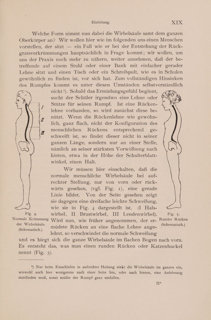 Welche Form nimmt nun dabei die Wirbelsäule samt dem ganzen Oberkörper an? Wir wollen hier wie im folgenden uns einen Menschen vorstellen, der sitzt — ein Fall wie er bei der Entstehung der Rück- gratsverkrümmungen hauptsächlich in Frage kommt; wir wollen, um uns der Praxis noch mehr zu nähern, weiter annehmen, daß der be- treffende auf einem Stuhl oder einer Bank mit einfacher gerader Lehne sitzt und einen Tisch oder ein Schreibpult, wie es in Schulen gewöhnlich zu finden ist, vor sich hat. Zum vollständigen Hinsinken des Rumpfes kommt es unter diesen Umständen selbstverständlich nicht!). Sobald das Ermüdungsgefühl beginnt, sucht der Schüler irgendwo eine Lehne oder Stütze für seinen Rumpf. Ist eine Rücken- lehne vorhanden, so wird zunächst diese be- nützt. Wenn die Rückenlehne wie gewöhn- lich, ganz flach, nicht der Konfiguration des menschlichen Rückens entsprechend ge- schweift ist, so findet dieser nicht in seiner ganzen Länge, sondern nur an einer Stelle, nämlich an seiner stärksten Vorwölbung nach hinten, etwa in der Höhe der Schulterblatt- winkel, einen Halt. Wir müssen hier einschalten, daß die normale menschliche Wirbelsäule bei auf- rechter Stellung, nur von vorn oder rück- wärts gesehen, (vgl. Fig. ı), eine gerade Linie bildet. Von. der’ Seite’ gesehen zeigt sie dagegen eine dreifache leichte Schweifung, wie sie in Fig. 4 dargestellt ist. (I Hals- Fig. 4. wirbel, II Brustwirbel, III Lendenwirbel. Fig. 5. Normale Krümmung Wird nun, wie früher angenommen, der er- Runder Rücken nn a müdete Rücken an eine flache Lehne ange- N lehnt, so verschwindet die normale Schweifung und es biegt sich die ganze Wirbelsäule im flachen Bogen nach vorn. Es entsteht das, was man einen runden Rücken oder Katzenbuckel nennt (Fig. 5). !) Nur beim Einschlafen in aufrechter Haltung sinkt die Wirbelsäule im ganzen ein, wiewohl auch hier wenigstens nach einer Seite hin, oder nach hinten, eine Anlehnung stattfinden muß, sonst müßte der Rumpf ganz umfallen. 17