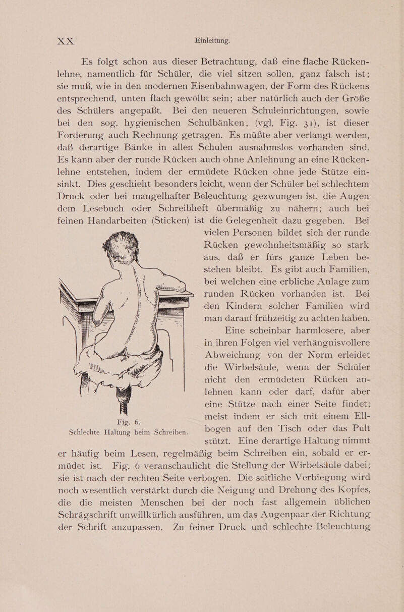 Es folgt schon aus dieser Betrachtung, daß eine flache Rücken- lehne, namentlich für Schüler, die viel sitzen sollen, ganz falsch ist; sie muß, wie in den modernen Eisenbahnwagen, der Form des Rückens entsprechend, unten flach gewölbt sein; aber natürlich auch der Größe des Schülers angepaßt. Bei den neueren Schuleinrichtungen, sowie bei den sog. hygienischen Schulbänken, (vgl. Fig. 31), ist dieser Forderung auch Rechnung getragen. Es müßte aber verlangt werden, daß derartige Bänke in allen Schulen ausnahmslos vorhanden sind. Es kann aber der runde Rücken auch ohne Anlehnung an eine Rücken- lehne entstehen, indem der ermüdete Rücken ohne jede Stütze ein- sinkt. Dies geschieht besonders leicht, wenn der Schüler bei schlechtem Druck oder bei mangelhafter Beleuchtung gezwungen ist, die Augen dem Lesebuch oder Schreibheft übermäßig zu nähern; auch bei feinen Handarbeiten (Sticken) ist die Gelegenheit dazu gegeben. Bei vielen Personen bildet sich der runde Rücken gewohnheitsmäßig so stark aus, daß er fürs ganze leben be- stehen bleibt. Es gibt auch Familien, bei welchen eine erbliche Anlage zum runden Rücken vorhanden ist. Bei den Kindern solcher Familien wird man darauf frühzeitig zu achten haben. Eine scheinbar harmlosere, aber in ihren Folgen viel verhängnisvollere Abweichung von der Norm erleidet die Wirbelsäule, wenn der Schüler nicht den ermüdeten Rücken an- lehnen kann oder darf, dafür aber eine Stütze nach einer Seite findet; meist indem er sich mit einem ElIl- bogen auf den Tisch oder das Pult stützt. Eine derartige Haltung nimmt er häufig beim Lesen, regelmäßig beim Schreiben ein, sobald er er- müdet ist. Fig. 6 veranschaulicht die Stellung der Wirbelsäule dabei; sie ist nach der rechten Seite verbogen. Die seitliche Verbiegung wird noch wesentlich verstärkt durch die Neigung und Drehung des Kopfes, die die meisten Menschen bei der noch fast allgemein üblichen Schrägschrift unwillkürlich ausführen, um das Augenpaar der Richtung der Schrift anzupassen. Zu feiner Druck und schlechte Beleuchtung