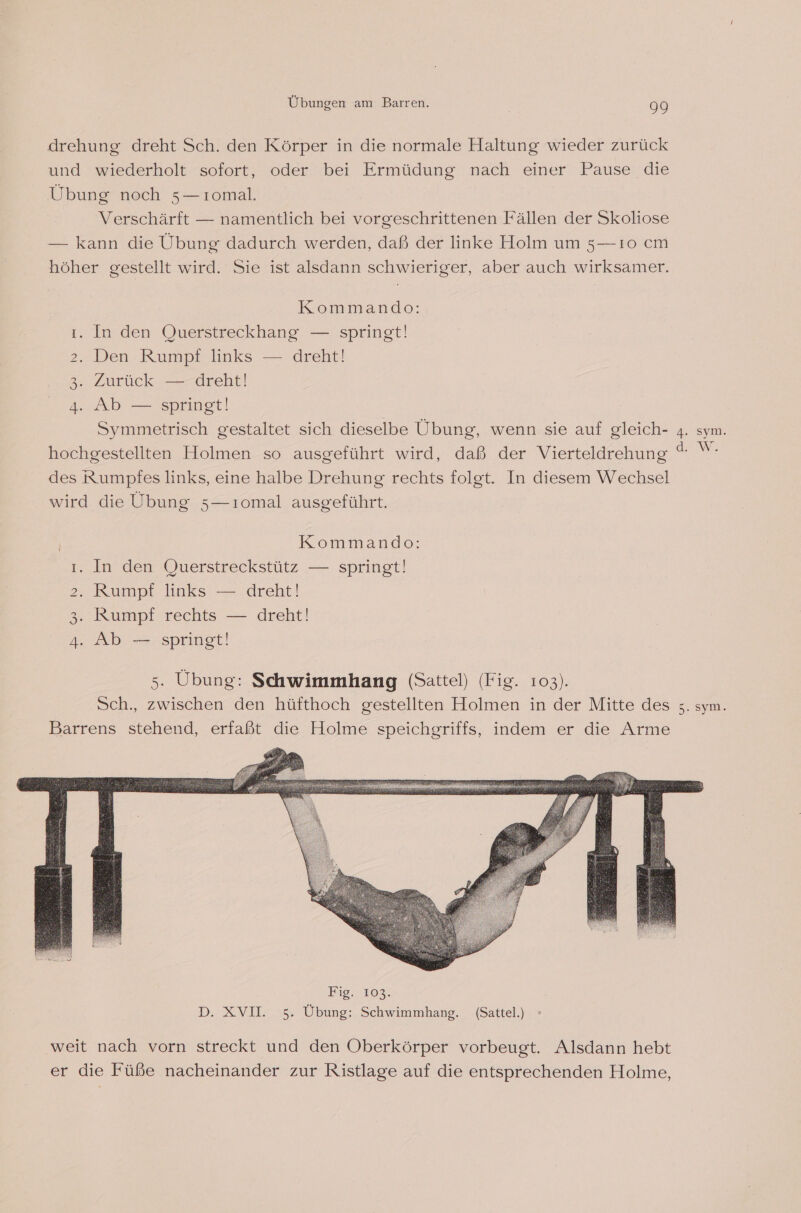 drehung dreht Sch. den Körper in die normale Haltung wieder zurück und wiederholt sofort, oder bei Ermüdung nach einer Pause die Übung noch 5—ıomal. Verschärft — namentlich bei vorgeschrittenen Fällen der Skoliose — kann die Übung dadurch werden, daß der linke Holm um 5—ı0 cm höher gestellt wird. Sie ist alsdann schwieriger, aber auch wirksamer. Kommando: ı. In den Querstreckhang — springt! . Den Rumpf links — dreht! Zurück — dreht! 4. Ab — springt! Symmetrisch gestaltet sich dieselbe Übung, wenn sie auf gleich- 4. sym. hochgestellten Holmen so ausgeführt wird, daß der Vierteldrehung u des Rumpfes links, eine halbe Drehung rechts folgt. In diesem Wechsel wird die Übung 5—ıomal ausgeführt. ID (@$) Kommando: ı. In den Querstreckstütz — springt! Rumpf links — dreht! Rumpf rechts — dreht! 4. Ab — springt! D &amp; Fig. 103. D. XVII. 5. Übung: Schwimmhang. (Sattel.) weit nach vorn streckt und den Oberkörper vorbeugt. Alsdann hebt er die Füße nacheinander zur Ristlage auf die entsprechenden Holme,