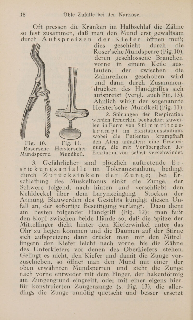 Oft pressen die Kranken im Halbschlaf die Zähne so fest zusammen, daß man den Mund erst gewaltsam durch Aufspreizen der Kiefer öffnen muß; dies geschieht durch die Roser’sche Mundsperre (Fig. 10), deren geschlossene Branchen vorne in einem Keile aus- laufen, der zwischen die Zahnreihen geschoben wird und dann durch Zusammen- ‘drücken des Handgriffes sich aufspreizt (vergl. auch Fig. 13). Ähnlich wirkt der sogenannte „ Heister’sche Mundkeil (Fig. 11). 2» 2. Störungen der Respiration werden fernerhin beobachtet zuwei- len inForm von Stimmritzen- krampf im Exzitationsstadium, wobei die Patienten kKrampfhaft Fig. 10. Fig. 11. den Atem anhalten: eine Erschei- Rosersche Heisterscher Nung, die mit Vorübergehen der Mundsperre. Mundkeil. Exzitation von selbst verschwindet. 3. Geefährlicher sind plötzlich auftretende Er- sticekungsanfälle im Toleranzstadium, bedingt durch Zurück sinken dert Zunge uber. Er- schlaffung des Muskeltonus sinkt die Zunge, der Schwere folgend, nach hinten und verschließt den Kehldeckel über dem Larynxeingang. Stocken der Atmung, Blauwerden des Gesichts kündigt diesen Un- fall an, der sofortige Beseitigung verlangt. Dazu dient am besten folgender Handgriff (Fig. 12): man faßt den Kopf zwischen beide Hände so, daß die Spitze der Mittelfinger dicht hinter den Kieferwinkel unter das Ohr zu liegen kommen und die Daumen auf der Stirne sich aufspreizen; dann drückt man mit den Mittel- fingern den Kiefer leicht nach vorne, bis die Zähne des Unterkiefers vor denen des Oberkiefers stehen. Gelingt es nicht, den Kiefer und damit die Zunge vor- zuschieben, so öffnet man den Mund mit einer der oben erwähnten Mundsperren und zieht die Zunge nach vorne entweder mit dem Finger, der hakenförmig am Zungengrund eingreift, oder mit einer eigens hier- für konstruierten Zungenzange (s. Fig. 13), die aller- dings die Zunge unnötig quetscht und besser ersetzt