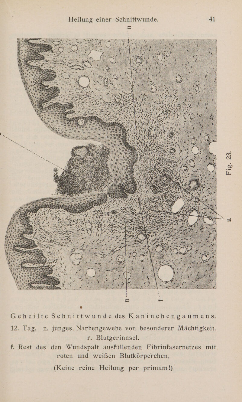 Gepeiltie Schnittwundeds Kanitchenzaumens; 12. Tag. n. junges. Narbengewebe von besonderer Mächtigkeit. r. Blutgerinnsel. f. Rest des den Wundspalt ausfüllenden Fibrinfasernetzes mit roten und weißen Blutkörperchen. (Keine reine Heilung per primam!)