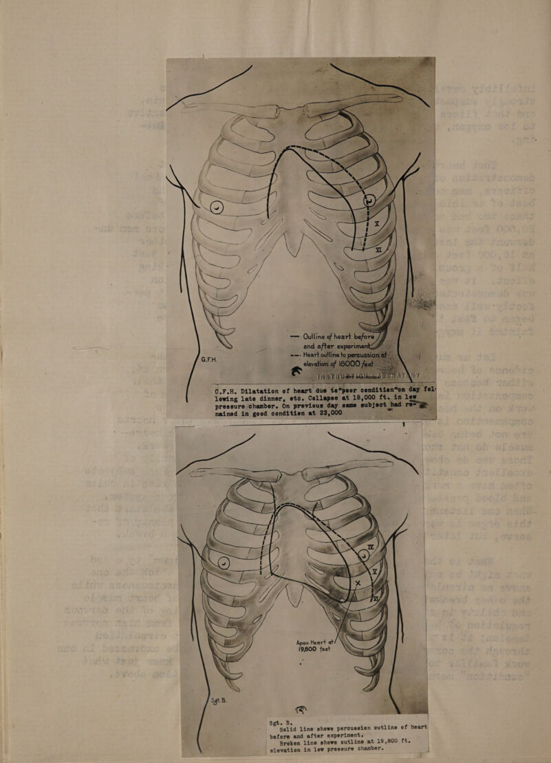 ' G.F.H. Dilatation of hear lowing late dinner, etc _ pressure chamber. On pre mained in good condition « Be , ; Solid line shows percussion outline of heart. before and after experiment. | | Broken line shows outline at 19,800 ft. : | elevation in low pressure chamber. : |