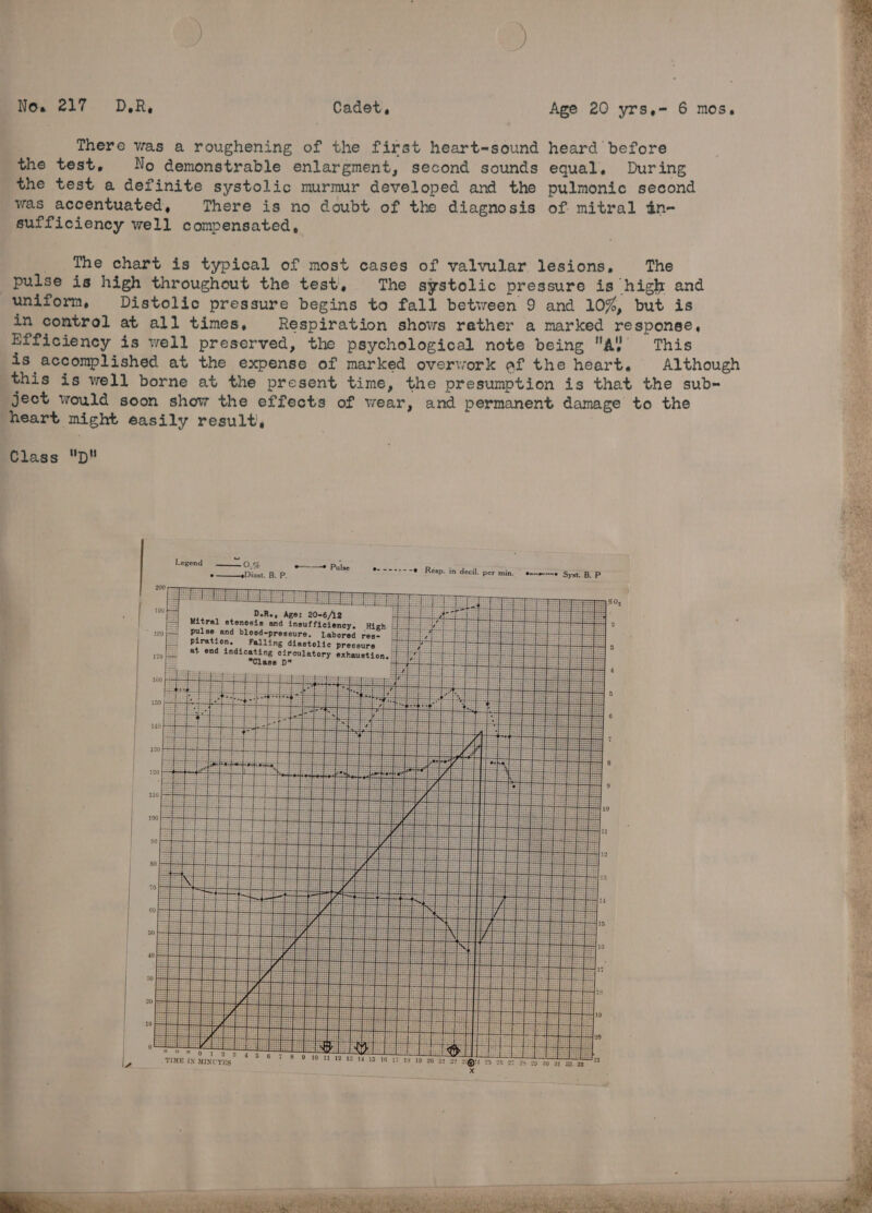 SS No. 217 DR, | Cadet, Age 20 yrsen 6 mos. There was a roughening of the first heart~sound ee Bit elagde the test, No demonstrable enlargment, second sounds equal, erat the test a definite systolic murmur developed and the pulmonic sec was accentuated, There is no doubt of the diagnosis of mitral in- sufficiency well compensated, chart is typical of most cases of valvular lesions, The pulse fe tes Loch ant the test, The systolic cap day eee ue uniform, Distolic pressure begins to fall between 9 and 10%, bu ? in control at all times, Respiration shows rather a ee one Efficiency is well preserved, the psychological note being a repeal is accomplished at the expense of marked overwork af the hear ; ‘eal ais this is well borne at the present time, the presumption is tha ei ject would soon show the effects of wear, and permanent damage to heart might easily result, lint Class D Legend = 0.% eum Pulse S255; -— 9 URésp. inidecil. per spin t eanpeore Syst. B. P , oe ———Diast. B. P. I 4 200 pe ged 7330} IESE Siad3 tata} © Ssisrrrister cores ageless rites S355 fy £0 ‘i PEE fein fides fap gas ' rf Sess EE etisfst ET] Se | = 3 a = ee] 2 4 190 F D.Re, Age: 20-6/12 eee : 454 2 . =z! Mitral stenosis and insufficiency. High | EEE | 7 ~ se9|-] pulse and blood-pressure. Labored res- _ ed a 4 =| piration, Falling diastolic pressure _ iss | _[. at end indicating circulatory exhaustion, | 4 5 10 “Class p pas es | 4 =a 4 Ea EEE HH Fa 12345 6 7 . TIME IN MINUTES RE &gt; ee