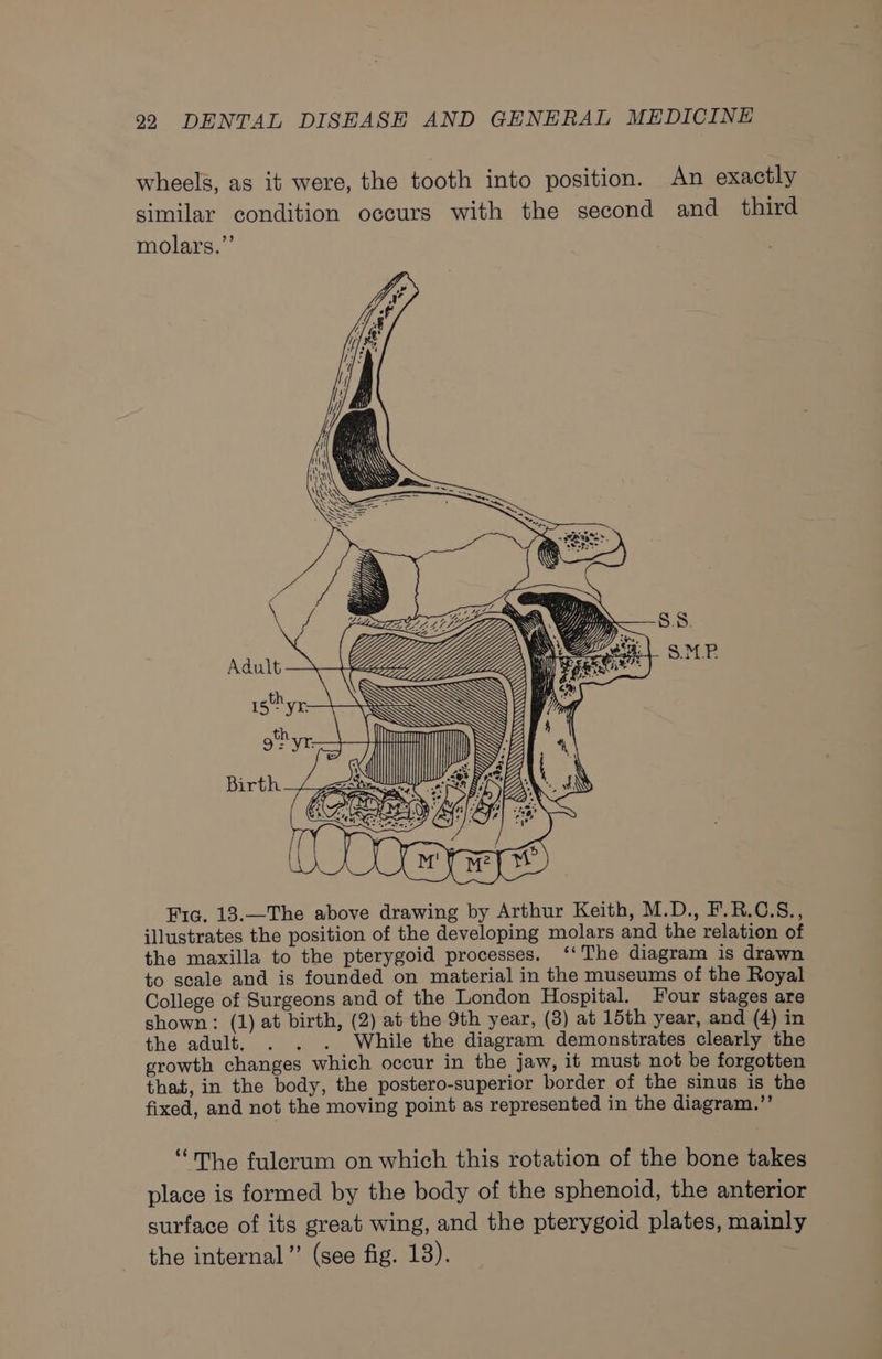 wheels, as it were, the tooth into position. An exactly similar condition occurs with the second and third molars.” x 3 is PV tt: | SMP Ne NaN : Mh os, — Adult &lt;\\ 15h yr. MON th 9: . A Birth ail fee Ze ae ft ; @ a FS,  LARD dy Fic. 13.—The above drawing by Arthur Keith, M.D., F.R.C.S., illustrates the position of the developing molars and the relation of the maxilla to the pterygoid processes. ‘‘The diagram is drawn to scale and is founded on material in the museums of the Royal College of Surgeons and of the London Hospital. Four stages are shown: (1) at birth, (2) at the 9th year, (3) at 15th year, and (4) in the adult. . . . While the diagram demonstrates clearly the growth changes which occur in the jaw, it must not be forgotten that, in the body, the postero-superior border of the sinus is the fixed, and not the moving point as represented in the diagram.”’ “he fulerum on which this rotation of the bone takes place is formed by the body of the sphenoid, the anterior surface of its great wing, and the pterygoid plates, mainly the internal” (see fig. 13).