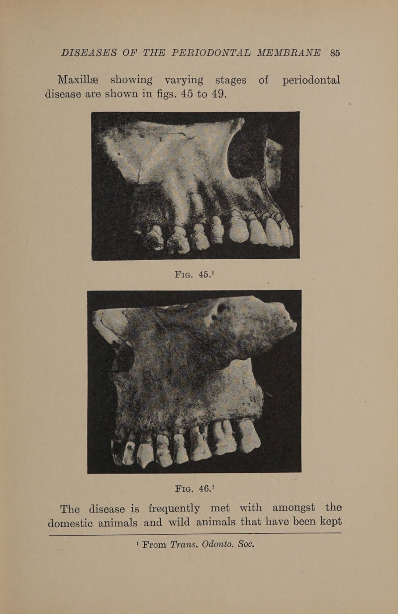 Maxilla showing varying stages of periodontal disease are shown in figs. 45 to 49. The disease is frequently met with amongst the domestic animals and wild animals that have been kept ‘From Trans, Odonto. Soc.