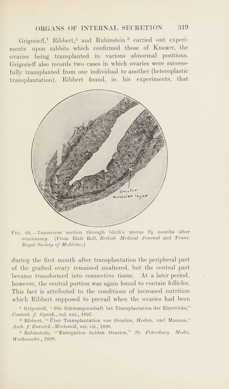 Grigorieff,! Ribbert,? and Rubinstein * carried out experi- ments upon rabbits which confirmed those of Knauer, the ovaries being transplanted in various abnormal positions. Grigorieff also records two cases in which ovaries were success- fully transplanted from one individual to another (heteroplastic transplantation). Ribbert found, in his experiments, that Fiqg. 68.—Transverse section through bitch’s uterus 9} months after ovariotomy. (From Blair Bell, British Medical Journal and Trans. Royal Soctety of Medicine.) during the first month after transplantation the peripheral part of the grafted ovary remained unaltered, but the central part became transformed into connective tissue. At a later period, however, the central portion was again found to contain follicles. This fact is attributed to the conditions of increased nutrition which Ribbert supposed to prevail when the ovaries had been 1 Grigorieff, ‘‘ Die Schwangerschaft bei Transplantation der Hierstocke,” Central. f. Gyndak., vol. xxi., 1897. 2 Ribbert, ‘‘ Uber Transplantation von Ovarien, Hoden, und Mamma,” Arch. f. Entwick,-Mechantk, vol. vii., 1898. 3 Rubinstein, ‘“‘Extirpation beiden Ovarien,’ St. Petersburg Mediz. Wochenschr., 1899.