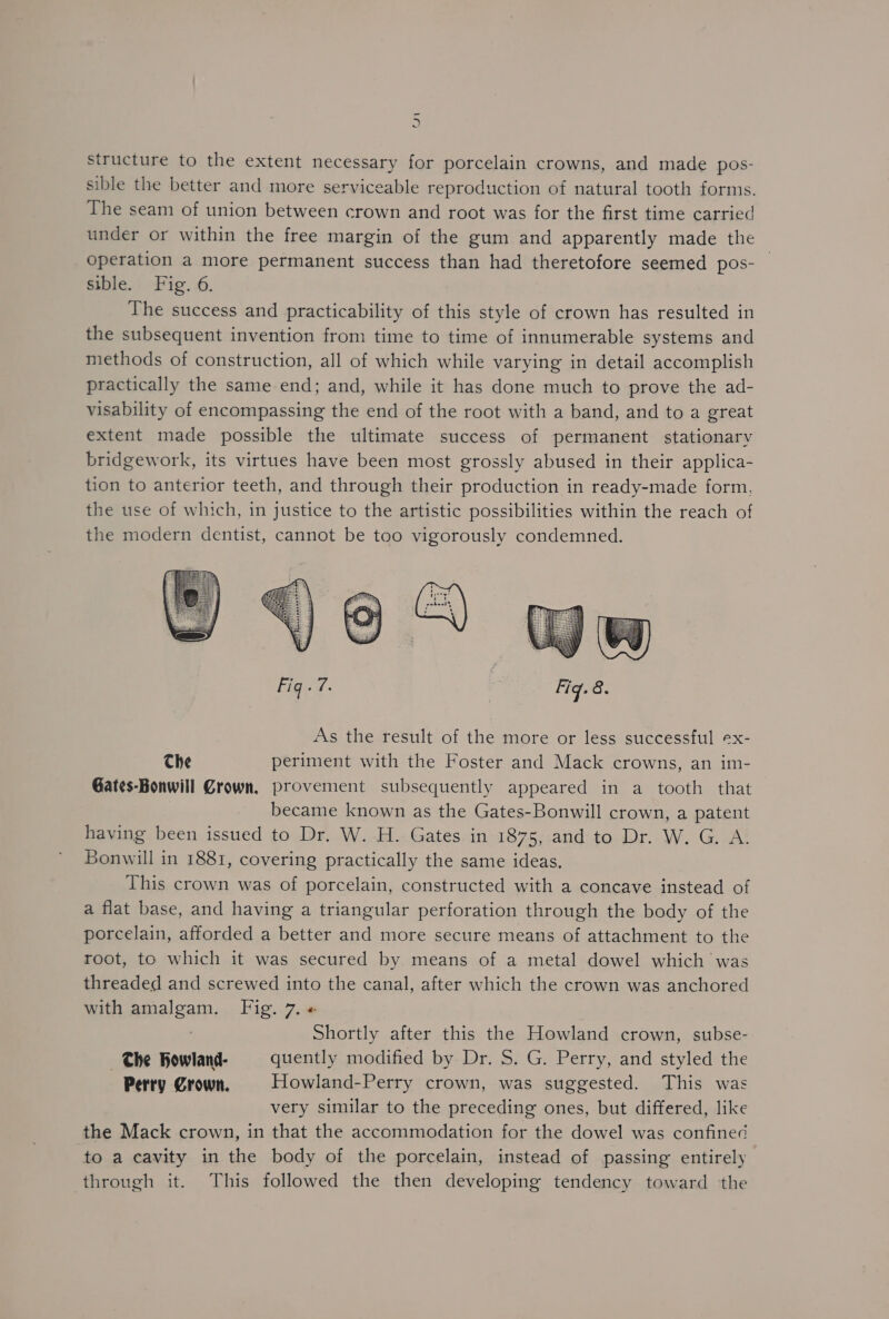 structure to the extent necessary for porcelain crowns, and made pos- sible the better and more serviceable reproduction of natural tooth forms. The seam of union between crown and root was for the first time carried under or within the free margin of the gum and apparently made the operation a more permanent success than had theretofore seemed pos- sible:' ig. .6. The success and practicability of this style of crown has resulted in the subsequent invention from time to time of innumerable systems and methods of construction, all of which while varying in detail accomplish practically the same end; and, while it has done much to prove the ad- visability of encompassing the end of the root with a band, and to a great extent made possible the ultimate success of permanent stationary bridgework, its virtues have been most grossly abused in their applica- tion to anterior teeth, and through their production in ready-made form. the use of which, in justice to the artistic possibilities within the reach of the modern dentist, cannot be too vigorously condemned. Fig ae: As the result of the more or less successful ex- Che periment with the Foster and Mack crowns, an im- Gates-Bonwill Grown, provement subsequently appeared in a tooth that became known as the Gates-Bonwill crown, a patent having been issued to Dr. W. H. Gates in 1875, and to Dr. W. G. A. Bonwill in 1881, covering practically the same ideas. This crown was of porcelain, constructed with a concave instead of a flat base, and having a triangular perforation through the body of the porcelain, afforded a better and more secure means of attachment to the root, to which it was secured by means of a metal dowel which was threaded and screwed into the canal, after which the crown was anchored with amalgam. Fig. 7. « | Shortly after this the Howland crown, subse- Che Howland- quently modified by Dr. S. G. Perry, and styled the | Perry Crown. Howland-Perry crown, was suggested. This was very similar to the preceding ones, but differed, like the Mack crown, in that the accommodation for the dowel was confined to a cavity in the body of the porcelain, instead of passing entirely through it. This followed the then developing tendency toward the